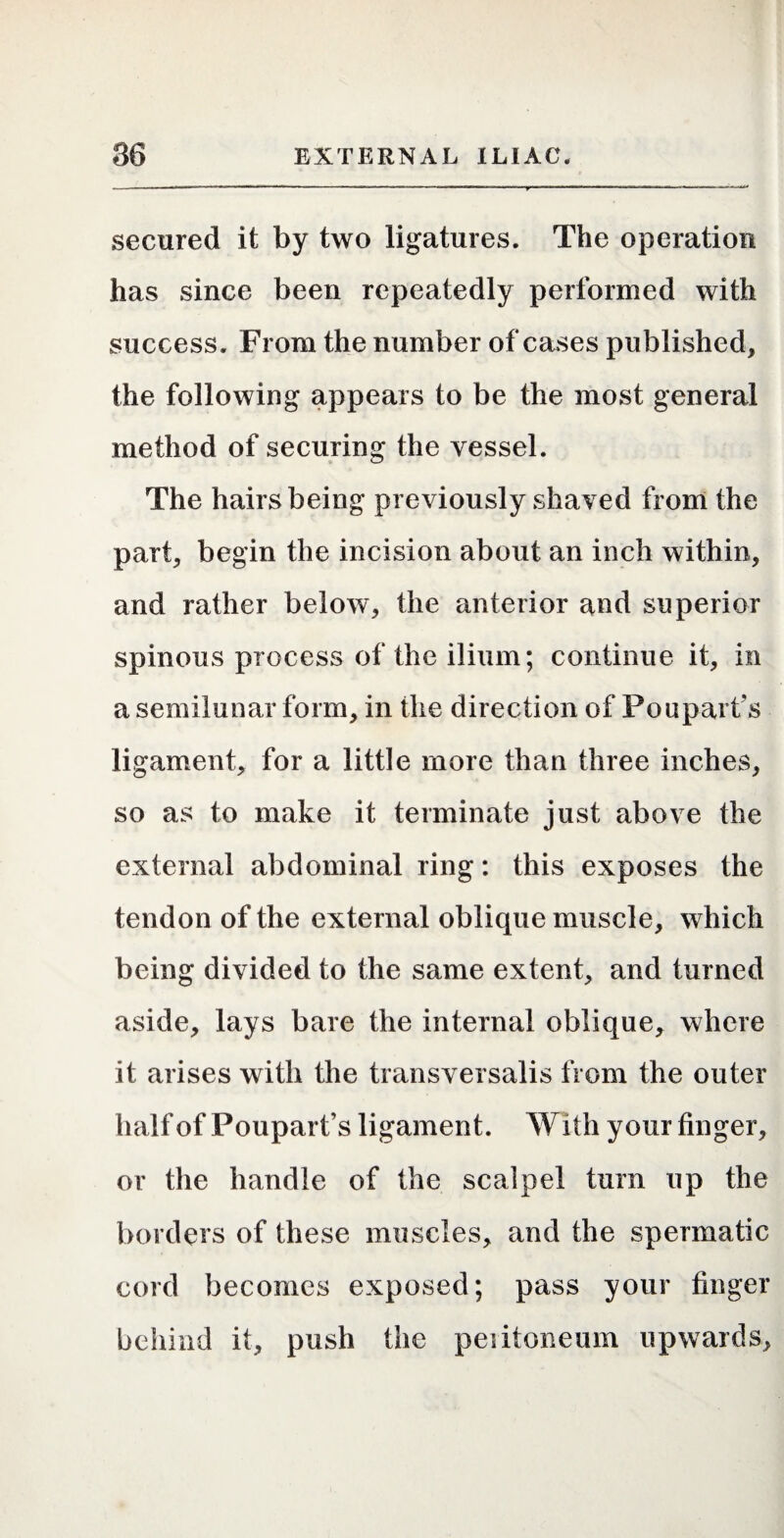 secured it by two ligatures. The operation has since been repeatedly performed with success. From the number of cases published, the following appears to be the most general method of securing the vessel. The hairs being previously shaved from the part, begin the incision about an inch within, and rather below, the anterior and superior spinous process of the ilium; continue it, in a semilunar form, in the direction of Pouparf s ligament, for a little more than three inches, so as to make it terminate just above the external abdominal ring; this exposes the tendon of the external oblique muscle, which being divided to the same extent, and turned aside, lays bare the internal oblique, where it arises with the transversalis from the outer halfof Poupart’s ligament. With your finger, or the handle of the scalpel turn up the borders of these muscles, and the spermatic cord becomes exposed; pass your finger behind it, push the peiitoneum upwards,