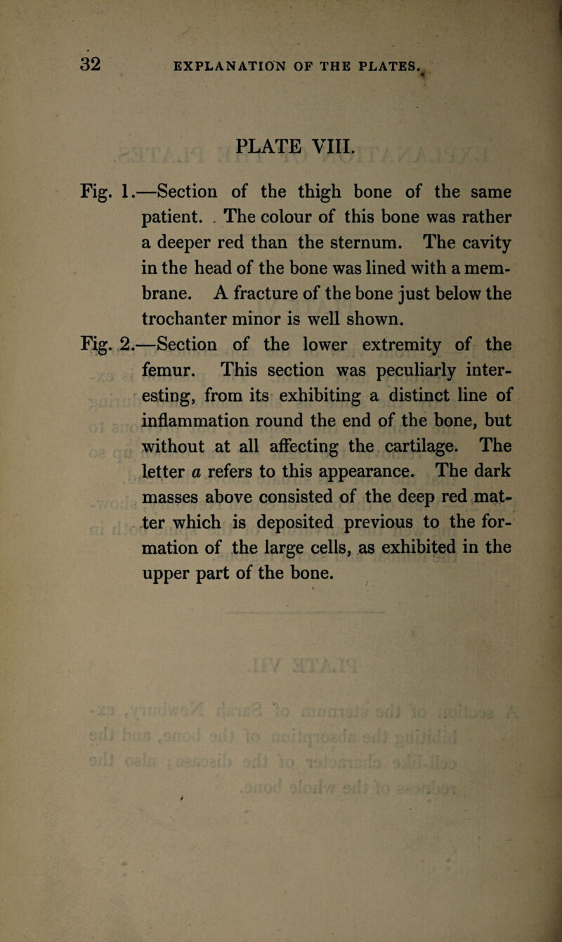 « PLATE VIII. Fig. 1.—Section of the thigh bone of the same patient. . The colour of this bone was rather a deeper red than the sternum. The cavity in the head of the bone was lined with a mem¬ brane. A fracture of the bone just below the trochanter minor is well shown. Fig. 2.—Section of the lower extremity of the femur. This section was peculiarly inter¬ esting, from its exhibiting a distinct line of inflammation round the end of the bone, but without at all affecting the cartilage. The letter a refers to this appearance. The dark masses above consisted of the deep red mat¬ ter which is deposited previous to the for¬ mation of the large cells, as exhibited in the upper part of the bone.