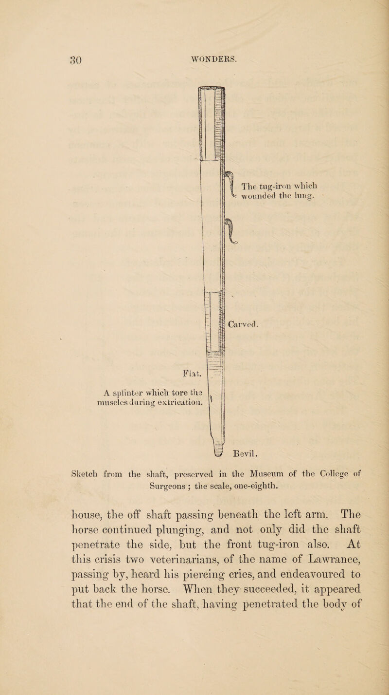 Flat. A splinter which tore the muscles daring extrication. The tug-iron which wounded the lung. Carved. Bevil. Sketch from the shaft, preserved in the Museum of the College of Surgeons ; the scale, one-eighth. house, the off shaft passing beneath the left arm. The horse continued plunging, and not only did tlie shaft penetrate the side, but the front tug-iron also. At tlris crisis two veterinarians, of the name of Lawrance, passing by, heard his piercing cries, and endeavoured to put back the horse. When they succeeded, it appeared that the end of the shaft, having penetrated the body of