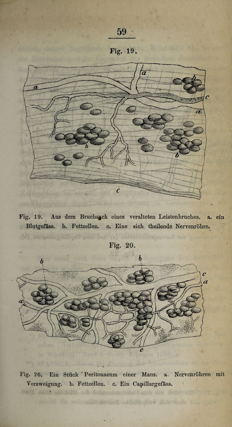 Fig. 19. Aus dem Brucli^ck eines veralteten Leistenbruches. a. ein Blutgefäss, b. Fettzellen, c. Eine sieb theilendo Nervenröhre. Fig. 20. Fig. 20. Ein Stück ' Peritonaeum einer Maus. a. Nervenröhren mit Verzweigung, b. Fettzellen. c. Ein Capillargefäss.