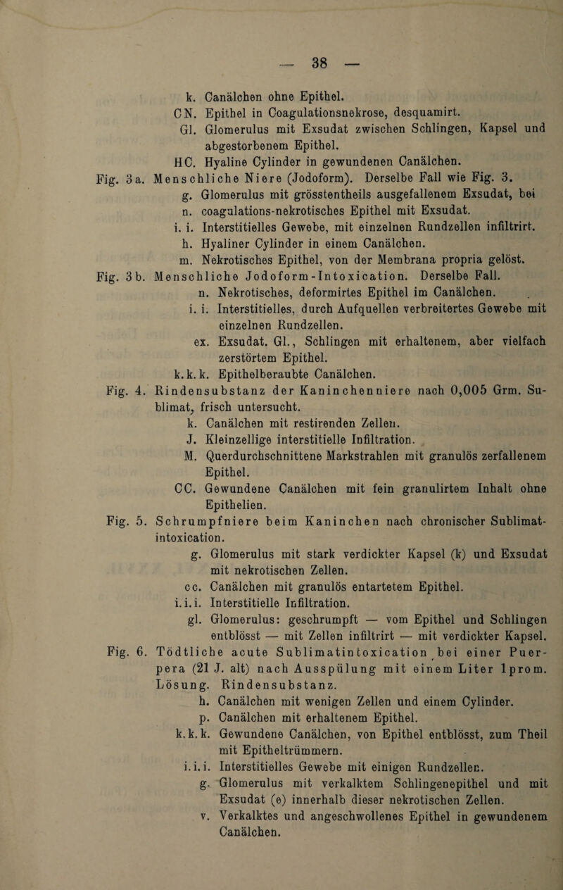 Fig. 3 a. Fig. 3 b. Fig. 4. Fig. 5. Fig. 6. k. Canälchen ohne Epithel. CN. Epithel in Coagulationsnekrose, desquamirt. Gl. Glomerulus mit Exsudat zwischen Schlingen, Kapsel und abgestorbenem Epithel. HC. Hyaline Cylinder in gewundenen Canälchen. Menschliche Niere (Jodoform). Derselbe Fall wie Fig. 3. g. Glomerulus mit grösstentheils ausgefallenem Exsudat, bei n. coagulations-nekrotisches Epithel mit Exsudat. i. i. Interstitielles Gewebe, mit einzelnen Rundzellen infiltrirt. h. Hyaliner Cylinder in einem Canälchen. m. Nekrotisches Epithel, von der Membrana propria gelöst. Menschliche Jodoform-Intoxication. Derselbe Fall, n. Nekrotisches, deformirtes Epithel im Canälchen. i. i. Interstitielles, durch Aufquellen verbreitertes Gewebe mit einzelnen Rundzellen. ex. Exsudat. Gl., Schlingen mit erhaltenem, aber vielfach zerstörtem Epithel, k.k. k. Epithelberaubte Canälchen. Rindensubstanz der Kanin chen niere nach 0,005 Grm. Su¬ blimat, frisch untersucht. k. Canälchen mit restirenden Zellen. J. Kleinzellige interstitielle Infiltration. M. Querdurchschnittene Markstrahlen mit granulös zerfallenem Epithel. CC. Gewundene Canälchen mit fein granulirtem Inhalt ohne Epithelien. Schrumpfniere beim Kaninchen nach chronischer Sublimat- intoxication. g. Glomerulus mit stark verdickter Kapsel (k) und Exsudat mit nekrotischen Zellen. cc. Canälchen mit granulös entartetem Epithel, i.i.i. Interstitielle Infiltration. gl. Glomerulus: geschrumpft — vom Epithel und Schlingen entblösst — mit Zellen infiltrirt — mit verdickter Kapsel. Tödtliche acute Sublimatin toxication bei einer Puer- pera (21 J. alt) nach Ausspülung mit einem Liter lprom. Lösung. Rindensubstanz. h. Canälchen mit wenigen Zellen und einem Cylinder. p. Canälchen mit erhaltenem Epithel, k.k.k. Gewundene Canälchen, von Epithel entblösst, zum Theil mit Epitheltrümmern. i. i.i. Interstitielles Gewebe mit einigen Rundzellec. g, Glomerulus mit verkalktem Schlingenepithel und mit Exsudat (e) innerhalb dieser nekrotischen Zellen, v. Verkalktes und angeschwollenes Epithel in gewundenem Canälchen.