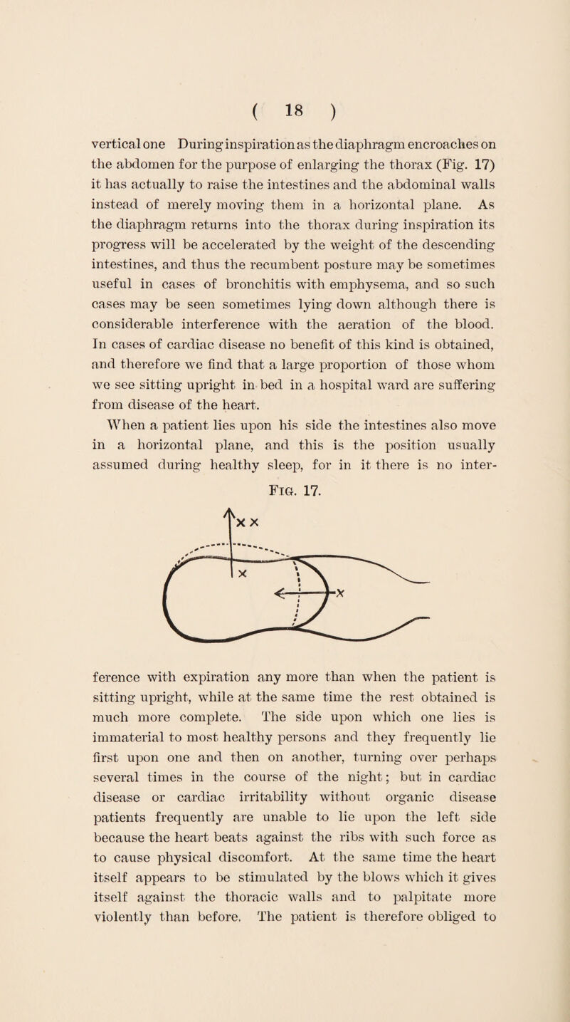 vertical one During inspiration as the diaphragm encroaches on the abdomen for the purpose of enlarging the thorax (Fig. 17) it has actually to raise the intestines and the abdominal walls instead of merely moving them in a horizontal plane. As the diaphragm returns into the thorax during inspiration its progress will be accelerated by the weight of the descending intestines, and thus the recumbent posture may be sometimes useful in cases of bronchitis with emphysema, and so such cases may be seen sometimes lying down although there is considerable interference with the aeration of the blood. In cases of cardiac disease no benefit of this kind is obtained, and therefore we find that a large proportion of those whom we see sitting upright in bed in a hospital ward are suffering from disease of the heart. When a patient lies upon his side the intestines also move in a horizontal plane, and this is the position usually assumed during healthy sleep, for in it there is no inter- Fig. 17. ference with expiration any more than when the patient is sitting upright, while at the same time the rest obtained is much more complete. The side upon which one lies is immaterial to most healthy persons and they frequently lie first upon one and then on another, turning over perhaps several times in the course of the night; but in cardiac disease or cardiac irritability without organic disease patients frequently are unable to lie upon the left side because the heart beats against the ribs with such force as to cause physical discomfort. At the same time the heart itself appears to be stimulated by the blows which it gives itself against the thoracic walls and to palpitate more violently than before, The patient is therefore obliged to