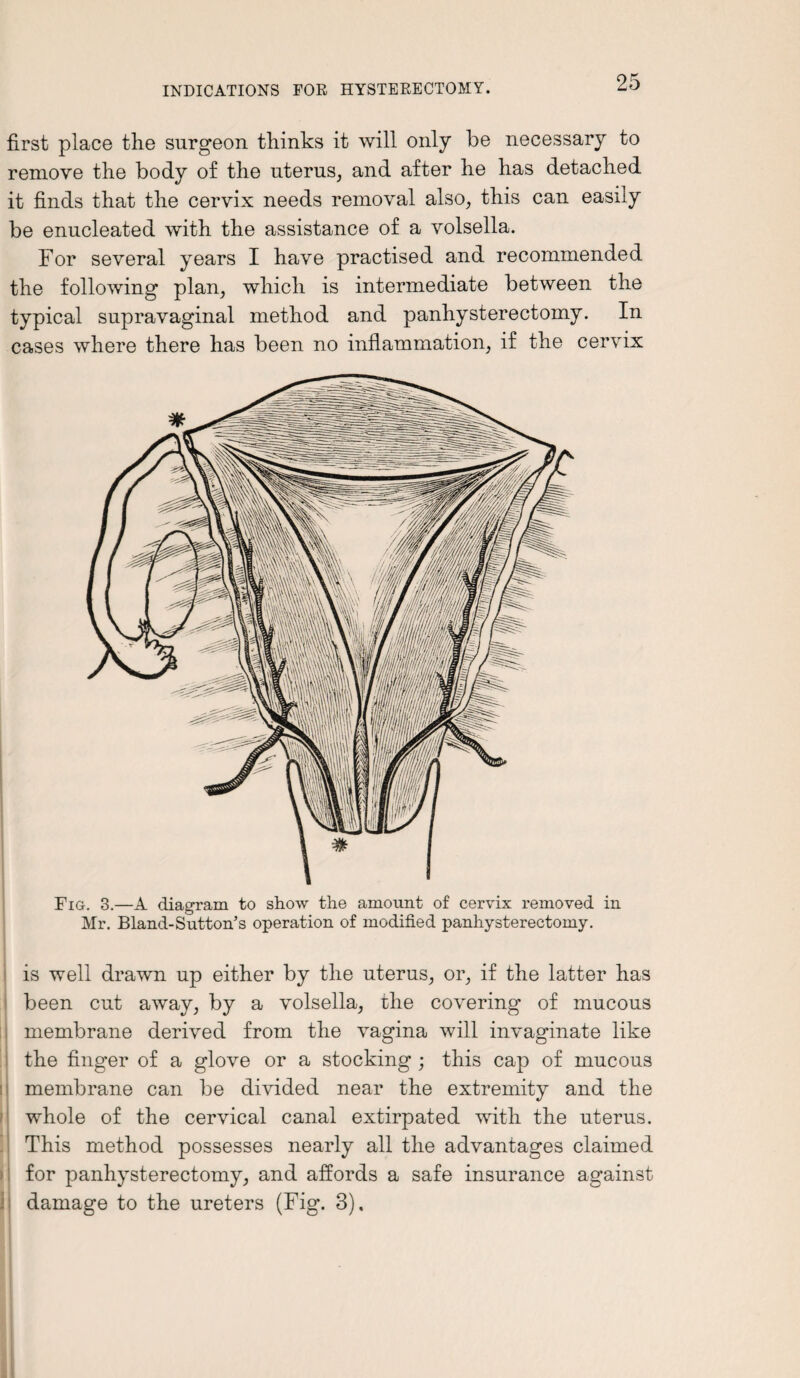 first place the surgeon thinks it will only be necessary to remove the body of the uterus, and after he has detached it finds that the cervix needs removal also, this can easily be enucleated with the assistance of a volsella. For several years I have practised and recommended the following plan, which is intermediate between the typical supravaginal method and panhysterectomy. In cases where there has been no inflammation, if the cervix Fig. 3.—A diagram to show the amount of cervix removed in Mr. Bland-Sutton’s operation of modified panhysterectomy. is well drawn up either by the uterus, or, if the latter has been cut away, by a volsella, the covering of mucous membrane derived from the vagina will invaginate like the finger of a glove or a stocking ; this cap of mucous membrane can be divided near the extremity and the whole of the cervical canal extirpated with the uterus. This method possesses nearly all the advantages claimed for panhysterectomy, and affords a safe insurance against damage to the ureters (Fig. 3),