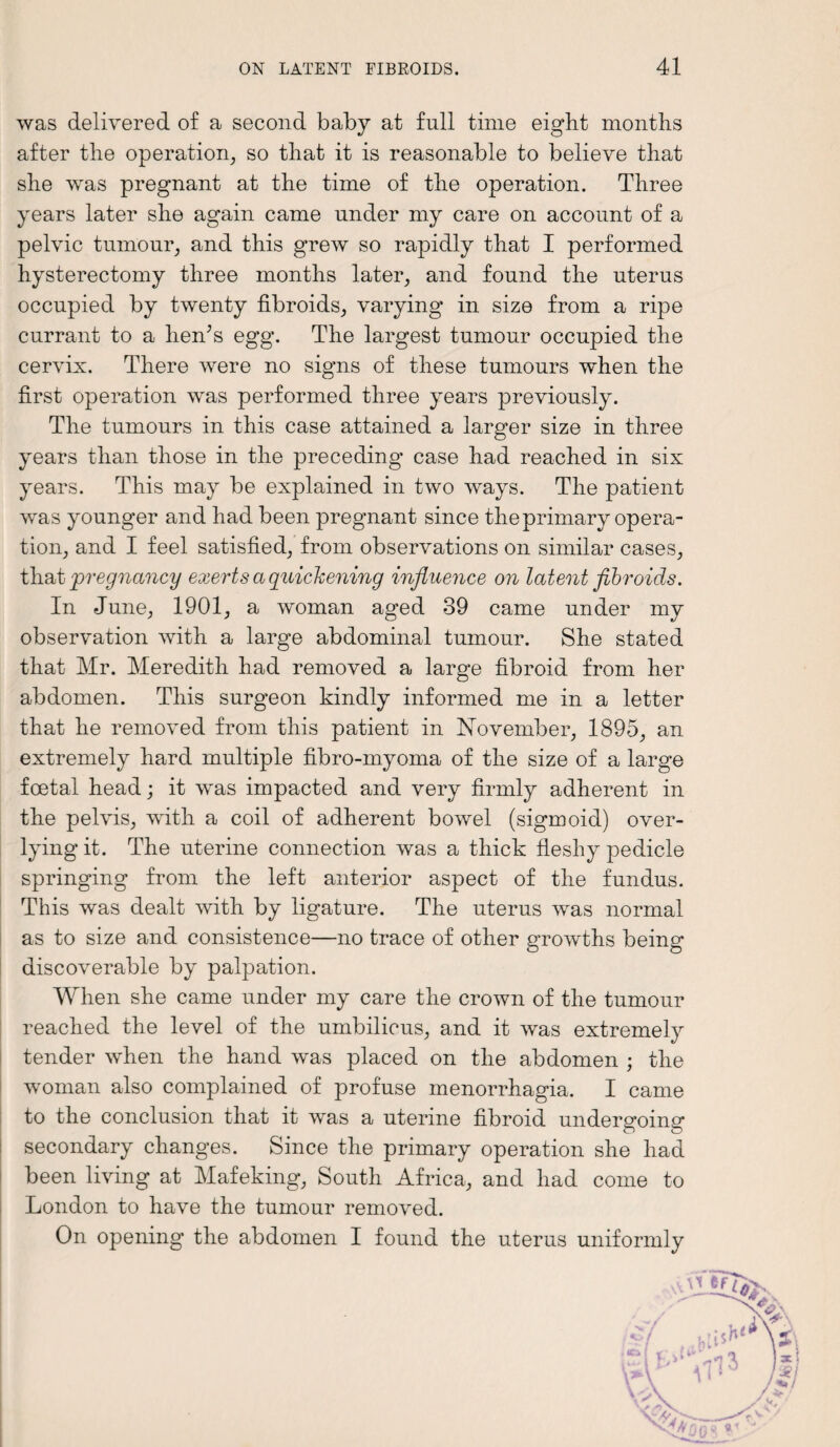 was delivered of a second baby at full time eight months after the operation, so that it is reasonable to believe that she was pregnant at the time of the operation. Three years later she again came under my care on account of a pelvic tumour, and this grew so rapidly that I performed hysterectomy three months later, and found the uterus occupied by twenty fibroids, varying in size from a ripe currant to a hen’s egg. The largest tumour occupied the cervix. There were no signs of these tumours when the first operation was performed three years previously. The tumours in this case attained a larger size in three years than those in the preceding case had reached in six years. This may be explained in two ways. The patient was younger and had been pregnant since the primary opera¬ tion, and I feel satisfied, from observations on similar cases, that pregnancy exerts a quickening influence on latent fibroids. In June, 1901, a woman aged 39 came under my observation with a large abdominal tumour. She stated that Mr. Meredith had removed a large fibroid from her abdomen. This surgeon kindly informed me in a letter that he removed from this patient in November, 1895, an extremely hard multiple fibro-myoma of the size of a large foetal head; it was impacted and very firmly adherent in the pelvis, with a coil of adherent bowel (sigmoid) over- lying it. The uterine connection was a thick fleshy pedicle springing from the left anterior aspect of the fundus. This was dealt with by ligature. The uterus was normal as to size and consistence—no trace of other growths being discoverable by palpation. When she came under my care the crown of the tumour reached the level of the umbilicus, and it was extremely tender when the hand was placed on the abdomen ; the woman also complained of profuse menorrhagia. I came to the conclusion that it was a uterine fibroid undergoing secondary changes. Since the primary operation she had been living at Mafeking, South Africa, and had come to London to have the tumour removed. On opening the abdomen I found the uterus uniformly