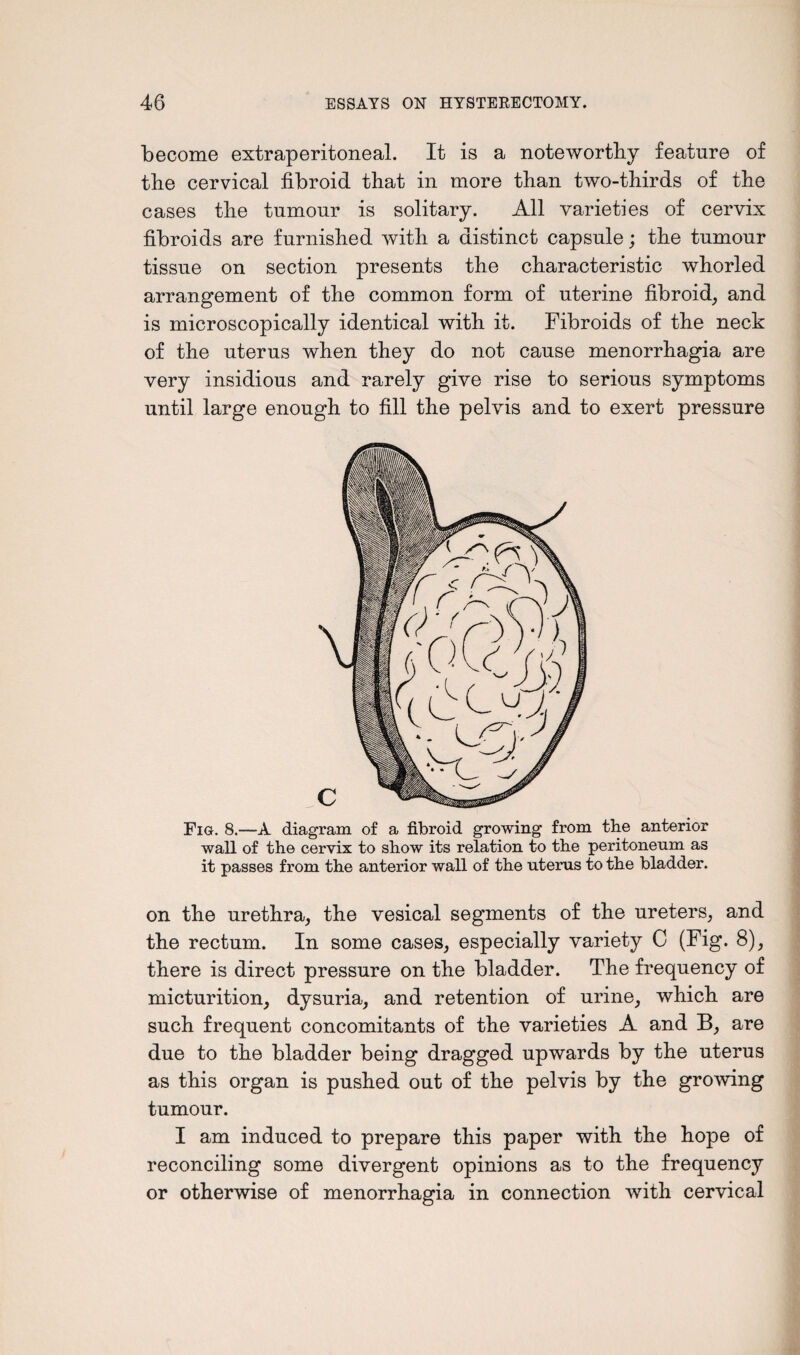 become extraperitoneal. It is a noteworthy feature of the cervical fibroid that in more than two-thirds of the cases the tumour is solitary. All varieties of cervix fibroids are furnished with a distinct capsule; the tumour tissue on section presents the characteristic whorled arrangement of the common form of uterine fibroid, and is microscopically identical with it. Fibroids of the neck of the uterus when they do not cause menorrhagia are very insidious and rarely give rise to serious symptoms until large enough to fill the pelvis and to exert pressure Fig. 8.—A diagram of a fibroid growing from the anterior wall of the cervix to show its relation to the peritoneum as it passes from the anterior wall of the uterus to the bladder. on the urethra, the vesical segments of the ureters, and the rectum. In some cases, especially variety C (Fig. 8), there is direct pressure on the bladder. The frequency of micturition, dysuria, and retention of urine, which are such frequent concomitants of the varieties A and B, are due to the bladder being dragged upwards by the uterus as this organ is pushed out of the pelvis by the growing tumour. I am induced to prepare this paper with the hope of reconciling some divergent opinions as to the frequency or otherwise of menorrhagia in connection with cervical