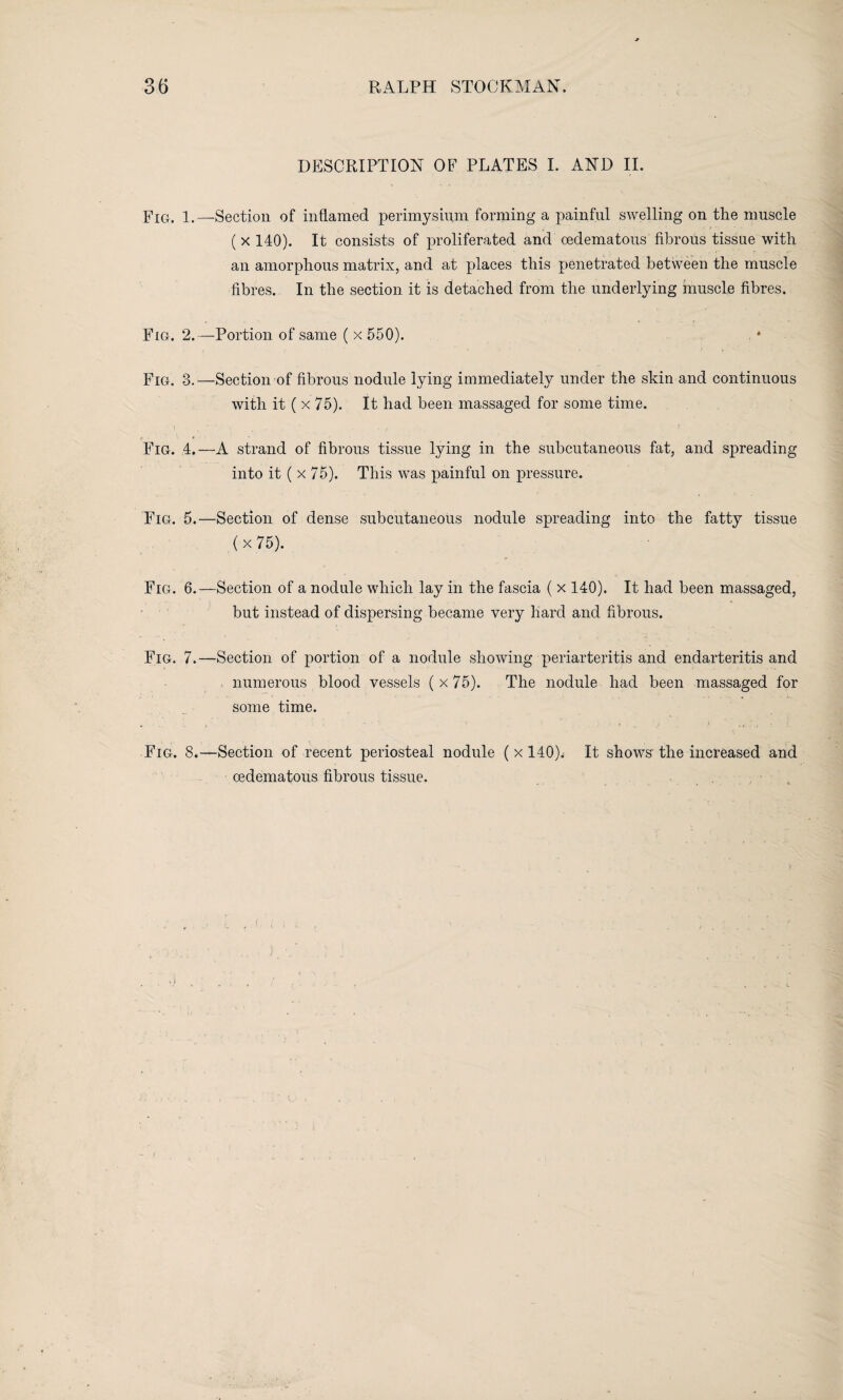DESCRIPTION OF PLATES I. AND II. Fig. i.—Section of inflamed perimysium forming a painful swelling on the muscle ( x 140). It consists of proliferated and cedematous fibrous tissue with an amorphous matrix, and at places this penetrated between the muscle fibres. In the section it is detached from the underlying muscle fibres. Fig. 2.—Portion of same ( x 550). * Fig. 3.—Section of fibrous nodule lying immediately under the skin and continuous with it ( x 75). It had been massaged for some time. Fig. 4.—A strand of fibrous tissue lying in the subcutaneous fat, and spreading into it ( x 75). This was painful on pressure. Fig. 5.—Section of dense subcutaneous nodule spreading into the fatty tissue (x 75). Fig. 6.—Section of a nodule which lay in the fascia ( x 140). It had been massaged, but instead of dispersing became very hard and fibrous. Fig. 7.—Section of portion of a nodule showing periarteritis and endarteritis and numerous blood vessels (x75). The nodule had been massaged for some time. Fig. 8.—Section of recent periosteal nodule ( x 140). It shows the increased and cedematous fibrous tissue.