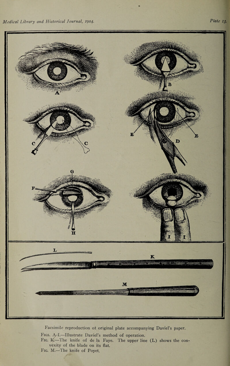 Facsimile reproduction ot original plate accompanying Daviel’s paper. Figs. A-I.—Illustrate Daviel’s method of operation. Fig. K.—The knife of de la Faye. The upper line (L) shows the con¬ vexity of the blade on its flat. Fig. M.—The knife of Poyet.