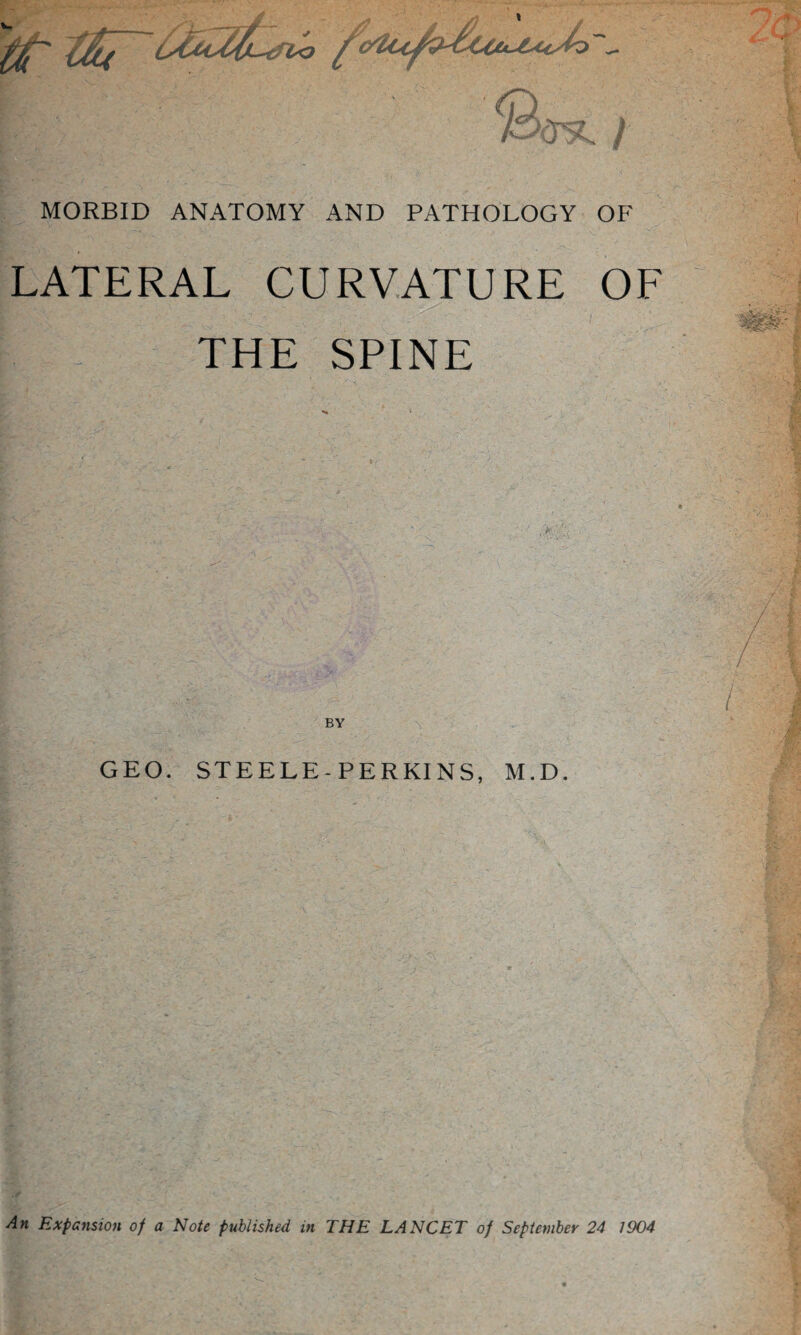 LATERAL CURVATURE OF THE SPINE BY GEO. STEELE-PERKINS, M.D. An Expansion op a Note published in THE LANCET of September 24 1904