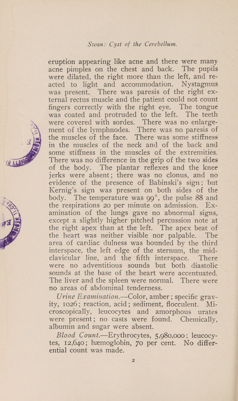 eruption appearing like acne and there were many acne pimples on the chest and back. The pupils were dilated, the right more than the left, and re¬ acted to light and accommodation. Nystagmus was present. There was paresis of the right ex¬ ternal rectus muscle and the patient could not count fingers correctly with the right eye. The tongue was coated and protruded to the left. The teeth were covered with sordes. There was no enlarge¬ ment of the lymphnodes. There was no paresis of the muscles of the face. There was some stiffness in the muscles of the neck and of the back and some stiffness in the muscles of the extremities. There was no difference in the grip of the two sides of the body. The plantar reflexes and the knee jerks were absent; there was no clonus, and no evidence of the presence of Babinski’s sign; but Kernig’s sign was present on both sides of the body. The temperature was 990, the pulse 88 and the respirations 20 per minute on admission. Ex¬ amination of the lungs gave no abnormal signs, except a slightly higher pitched percussion note at the right apex than at the left. The apex beat of the heart was neither visible nor palpable. The area of cardiac dulness was bounded by the third interspace, the left edge of the sternum, the mid- clavicular line, and the fifth interspace. There were no adventitious sounds but both diastolic sounds at the base of the heart were accentuated. The liver and the spleen were normal. There were no areas of abdominal tenderness. Urine Examination.—Color, amber; specific grav¬ ity, 1026; reaction, acid; sediment, flocculent. Mi¬ croscopically, leucocytes and amorphous urates were present; no casts were found. Chemically, albumin and sugar were absent. Blood Count.—Erythrocytes, 5,980,000; leucocy¬ tes, 12,640; haemoglobin, 70 per cent. No differ¬ ential count was made.