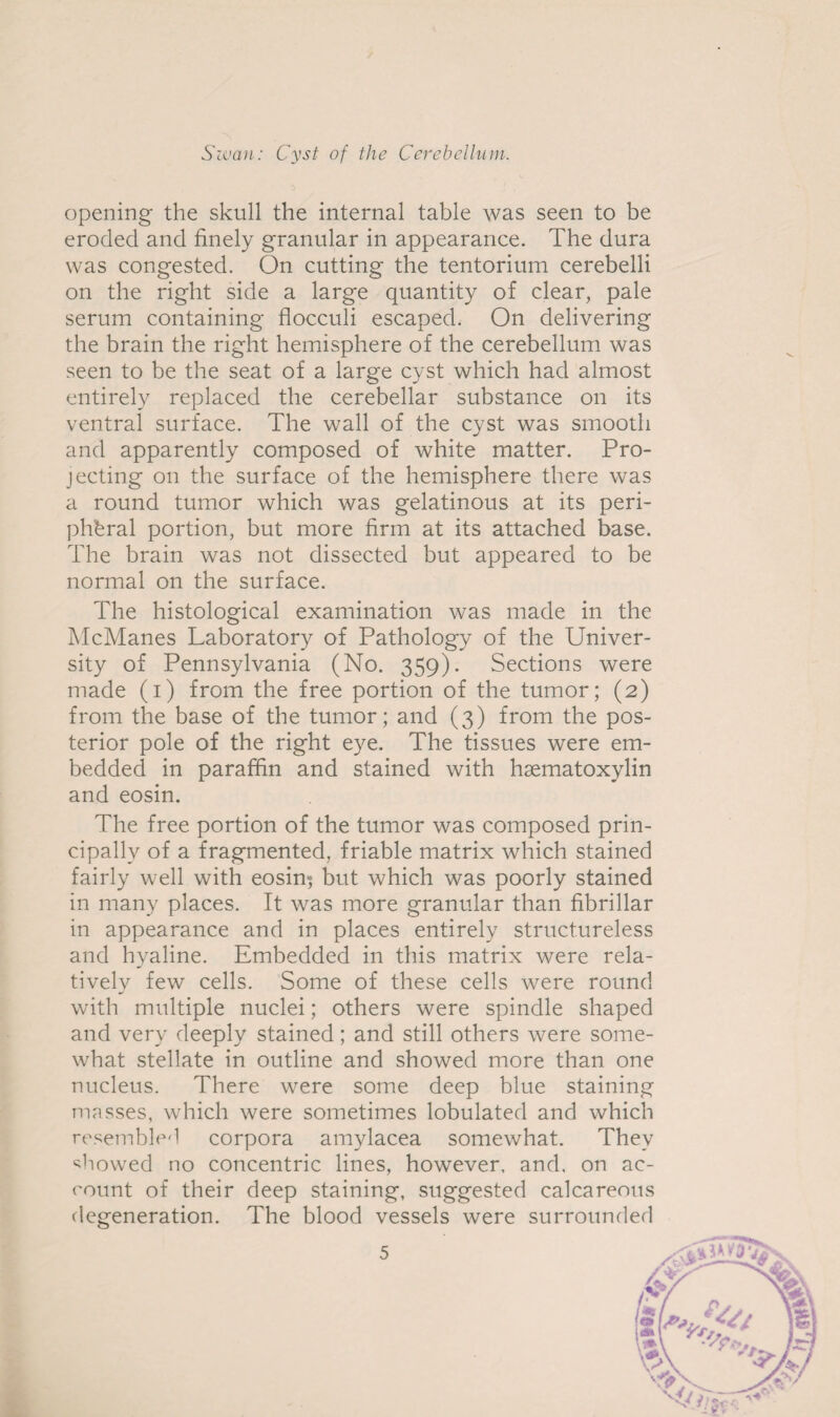 opening the skull the internal table was seen to be eroded and finely granular in appearance. The dura was congested. On cutting the tentorium cerebelli on the right side a large quantity of clear, pale serum containing flocculi escaped. On delivering the brain the right hemisphere of the cerebellum was seen to be the seat of a large cyst which had almost entirely replaced the cerebellar substance on its ventral surface. The wall of the cyst was smooth and apparently composed of white matter. Pro¬ jecting on the surface of the hemisphere there was a round tumor which was gelatinous at its peri¬ pheral portion, but more firm at its attached base. The brain was not dissected but appeared to be normal on the surface. The histological examination was made in the McManes Laboratory of Pathology of the Univer¬ sity of Pennsylvania (No. 359). Sections were made (1) from the free portion of the tumor; (2) from the base of the tumor; and (3) from the pos¬ terior pole of the right eye. The tissues were em¬ bedded in paraffin and stained with hsematoxylin and eosin. The free portion of the tumor was composed prin¬ cipally of a fragmented, friable matrix which stained fairly well with eosin; but which was poorly stained in many places. It was more granular than fibrillar in appearance and in places entirely structureless and hyaline. Embedded in this matrix were rela¬ tively few cells. Some of these cells were round with multiple nuclei; others were spindle shaped and very deeply stained; and still others were some¬ what stellate in outline and showed more than one nucleus. There were some deep blue staining masses, which were sometimes lobulated and which resembled corpora amylacea somewhat. They showed no concentric lines, however, and, on ac¬ count of their deep staining, suggested calcareous degeneration. The blood vessels were surrounded