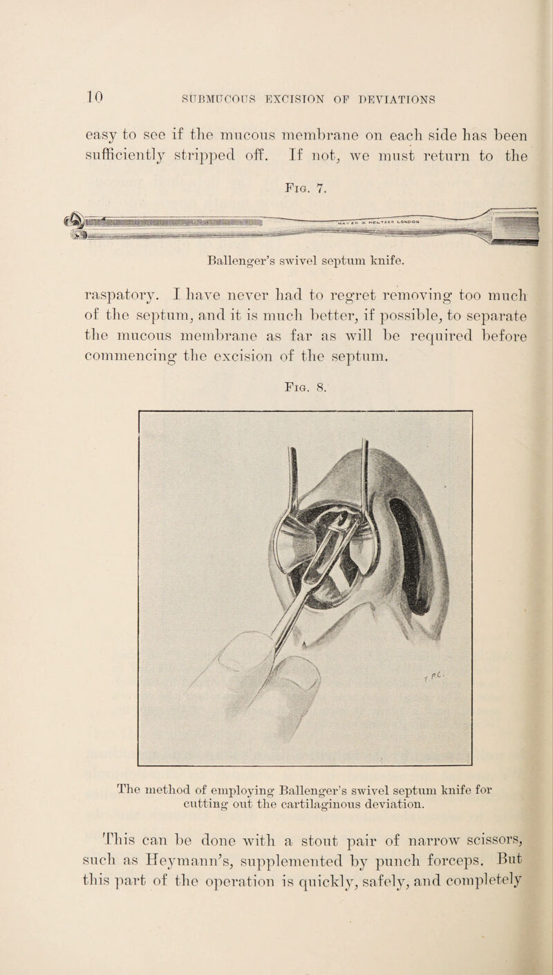 easy to see if the mucous membrane on each side lias been sufficiently stripped off. If not, we must return to the Fiu. 7. Ballenger’s swivel septum knife. raspatory. I have never had to regret removing too much of the septum, and it is much better, if possible, to separate the mucous membrane as far as will be required before commencing the excision of the septum. Fig. 8. The method of employing Ballenger’s swivel septum knife for cutting out the cartilaginous deviation. This can be done with a stout pair of narrow scissors, such as Hey man ids, supplemented by punch forceps. But this part of the operation is quickly, safely, and completely