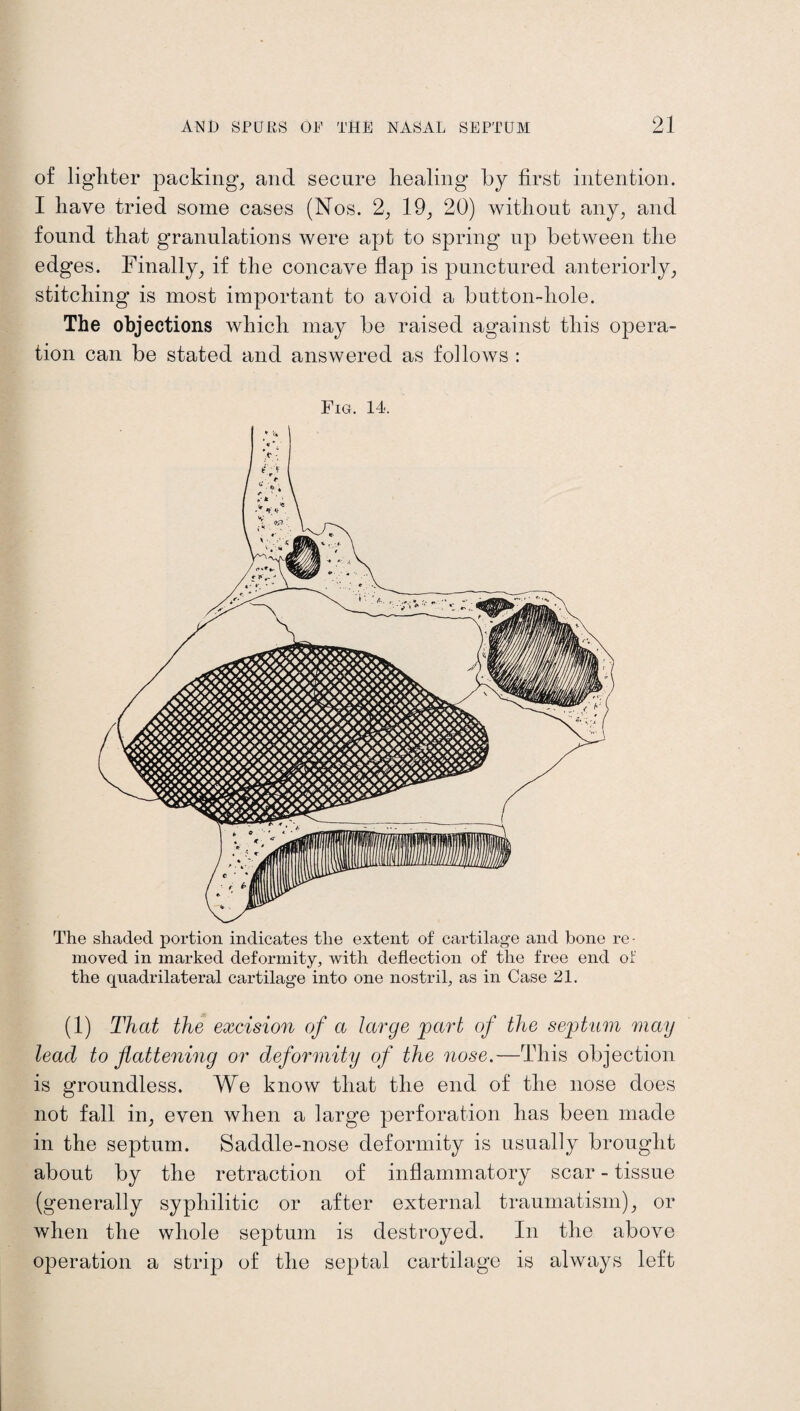 of lighter packing, and secure healing by first intention. I have tried some cases (Nos. 2, 19, 20) without any, and found that granulations were apt to spring up between the edges. Finally, if the concave flap is punctured anteriorly, stitching is most important to avoid a button-hole. The objections which may be raised against this opera¬ tion can be stated and answered as follows : Fig. 14. The shaded portion indicates the extent of cartilage and bone re¬ moved in marked deformity, with deflection of the free end of the quadrilateral cartilage into one nostril, as in Case 21. (1) That the excision of a large part of the septum may lead to flattening or deformity of the nose.—This objection is groundless. We know that the end of the nose does not fall in, even when a large perforation has been made in the septum. Saddle-nose deformity is usually brought about by the retraction of inflammatory scar - tissue (generally syphilitic or after external traumatism), or when the whole septum is destroyed. In the above operation a strip of the septal cartilage is always left