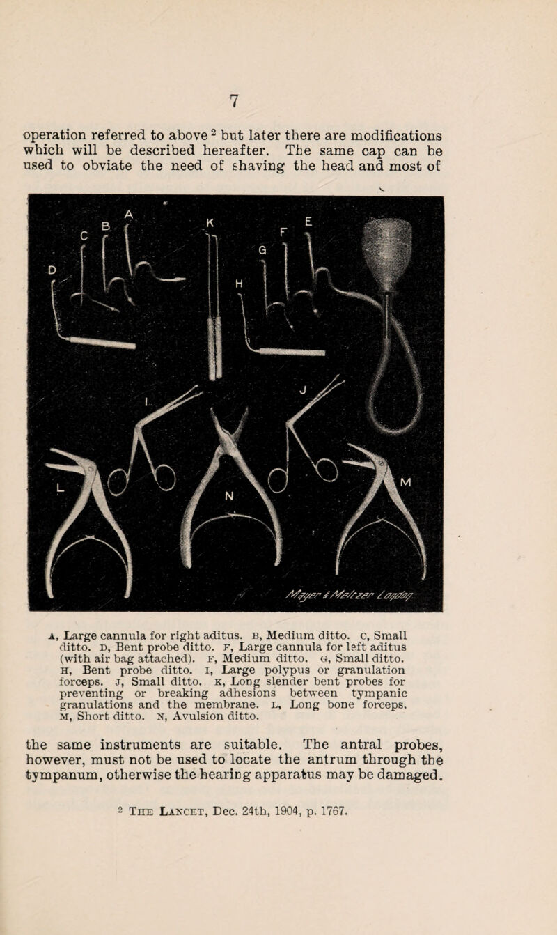 operation referred to above2 but later there are modifications which will be described hereafter. The same cap can be used to obviate the need of shaving the head and most of A, Large cannula for right aditus. b, Medium ditto, c, Small ditto, d, Bent probe ditto, f, Large cannula for left aditus (with air bag attached). F, Medium ditto. G, Small ditto. H, Bent probe ditto. I, Large polypus or granulation forceps, j, Small ditto, k, Long slender bent probes for preventing or breaking adhesions between tympanic granulations and the membrane. L, Long bone forceps. M, Short ditto. N, Avulsion ditto. the same instruments are suitable. The antral probes, however, must not be used to locate the antrum through the tympanum, otherwise the hearicg apparatus may be damaged.