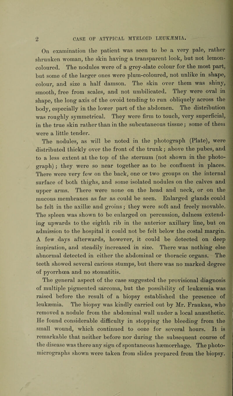 On examination the patient was seen to be a very pale, rather shrunken woman, the skin having a transparent look, but not lemon- coloured. The nodules were of a grey-slate colour for the most part, but some of the larger ones were plum-coloured, not unlike in shape, colour, and size a half damson. The skin over them was shiny, smooth, free from scales, and not umbilicated. They were oval in shape, the long axis of the ovoid tending to run obliquely across the body, especially in the lower part of the abdomen. The distribution was roughly symmetrical. They were firm to touch, very superficial, in the true skin rather than in the subcutaneous tissue; some of them were a little tender. The nodules, as will be noted in the photograph (Plate), were distributed thickly over the front of the trunk; above the pubes, and to a less extent at the top of the sternum (not shown in the photo¬ graph) ; they were so near together as to be confluent in places. Thei’e were very few on the back, one or two groups on the internal surface of both thighs, and some isolated nodules on the calves and upper arms. There were none on the head and neck, or on the mucous membranes as far as could be seen. Enlarged glands could be felt in the axillae and groins; they were soft and freely movable. The spleen was shown to be enlarged on percussion, dulness extend¬ ing upwards to the eighth rib in the anterior axillary line, but on admission to the hospital it could not be felt below the costal margin. A few days afterwards, however, it could be detected on deep inspiration, and steadily increased in size. There was nothing else abnormal detected in either the abdominal or thoracic organs. The teeth showed several carious stumps, but there was no marked degree of pyorrhoea and no stomatitis. The general aspect of the case suggested the provisional diagnosis of multiple pigmented sarcoma, but the possibility of leukaemia was raised before the result of a biopsy established the presence of leukaemia. The biopsy was kindly carried out by Mr. Fraukau, who removed a nodule from the abdominal wall under a local anaesthetic. He found considerable difficulty in stopping the bleeding from the small wound, which continued to ooze for several hours. It is remarkable that neither before nor during the subsequent course of the disease was there any sign of spontaneous haemorrhage. The photo¬ micrographs shown were taken from slides prepared from the biopsy.