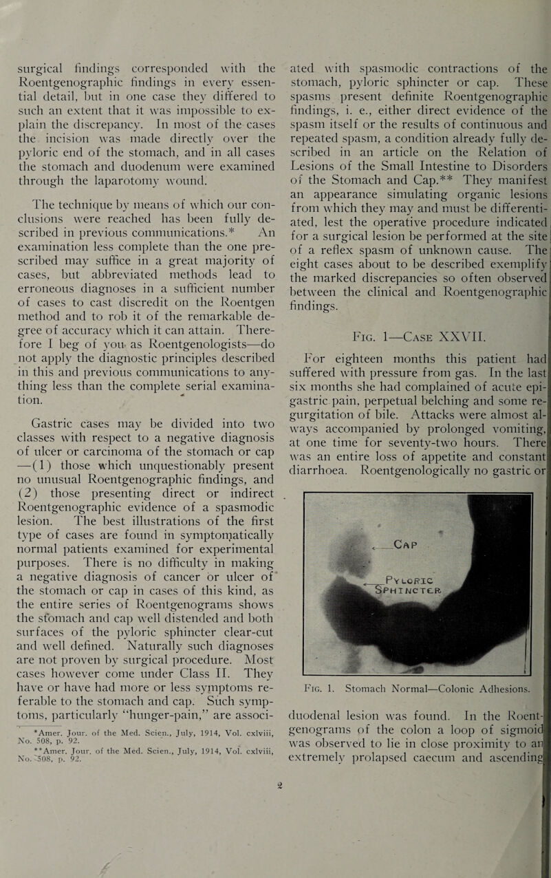 surgical findings corresponded with the Roentgenographic findings in every essen¬ tial detail, but in one case they differed to such an extent that it was impossible to ex¬ plain the discrepancy. In most of the cases the incision was made directly over the pyloric end of the stomach, and in all cases the stomach and duodenum were examined through the laparotomy wound. The technique by means of which our con¬ clusions were reached has been fully de¬ scribed in previous communications.* An examination less complete than the one pre¬ scribed may suffice in a great majority of cases, but abbreviated methods lead to erroneous diagnoses in a sufficient number of cases to cast discredit on the Roentgen method and to rob it of the remarkable de¬ gree of accuracy which it can attain. There¬ fore I beg of you as Roentgenologists—do not apply the diagnostic principles described in this and previous communications to any¬ thing less than the complete serial examina¬ tion. Gastric cases may be divided into two classes with respect to a negative diagnosis of ulcer or carcinoma of the stomach or cap — (1) those which unquestionably present no unusual Roentgenographic findings, and (2) those presenting direct or indirect Roeiitgenographic evidence of a spasmodic lesion. The best illustrations of the first type of cases are found in symptomatically normal patients examined for experimental purposes. There is no difficulty in making a negative diagnosis of cancer or ulcer of the stomach or cap in cases of this kind, as the entire series of Roentgenograms shows the stomach and cap well distended and both surfaces of the pyloric sphincter clear-cut and well defined. Naturally such diagnoses are not proven by surgical procedure. Most cases however come under Class II. They have or have had more or less symptoms re¬ ferable to the stomach and cap. Such symp¬ toms, particularly “hunger-pain,” are associ¬ *Amer. Jour, of the Med. Scien., July, 1914, Vol. cxlviii, No. 508, p. 92. **Amer. Jour, of the Med. Scien., July, 1914, Vol. cxlviii, No. 508, p. 92. ated with spasmodic contractions of the stomach, pyloric sphincter or cap. These spasms present definite Roentgenographic findings, i. e., either direct evidence of the spasm itself or the results of continuous and repeated spasm, a condition already fully de¬ scribed in an article on the Relation of Lesions of the Small Intestine to Disorders of the Stomach and Cap.** They manifest an appearance simulating organic lesions from which they may and must be differenti¬ ated, lest the operative procedure indicated for a surgical lesion be performed at the site of a reflex spasm of unknown cause. The eight cases about to be described exemplify the marked discrepancies so often observed between the clinical and Roentgenographic findings. Fig. 1—Case XXVII. For eighteen months this patient had suffered with pressure from gas. In the last six months she had complained of acute epi¬ gastric pain, perpetual belching and some re¬ gurgitation of bile. Attacks were almost al-i| ways accompanied by prolonged vomiting, at one time for seventy-two hours. There was an entire loss of appetite and constan diarrhoea. Roentgenologically no gastric or Fig. 1. Stomach Normal—Colonic Adhesions. duodenal lesion was found. In the Roent¬ genograms of the colon a loop of sigmoid was observed to lie in close proximity to an extremely prolapsed caecum and ascending