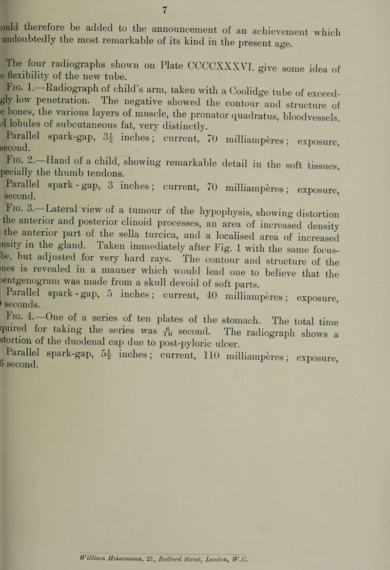 ould therefore be added to the announcement of an achievement which undoubtedly the most remarkable of its kind in the present age. The four radiographs shown on Plate CCCCXXXVI. give some idea of e flexibility of the new tube. Fig. 1.—Radiograph of child’s arm, taken with a Coolidge tube of exceed- gly low penetration. The negative showed the contour and structure of e bones, the various layers of muscle, the pronator quadratus, bloodvessels A lobules of subcutaneous fat, very distinctly. Parallel spark-gap, 3| inches; current, 70 milliamperes; exposure second. ’ Fig. 2. Hand of a child, showing remarkable detail in the soft tissues pecially the thumb tendons. Parallel spark - gap, 3 inches; current, 70 milliamperes; exposure second. ’ Fig. o. -Lateral view of a tumour of the hypophysis, showing distortion the anterior and posterior clinoid processes, an area of increased density the anterior part of the sella turcica, and a localised area of increased risity m the gland. Taken immediately after Fig. 1 with the same focus- be, but adjusted for very hard rays. The contour and structure of the lnes 1S revealed in a manner which would lead one to believe that the oentgenogram was made from a skull devoid of soft parts. Parallel spark - gap, 5 inches; current, 40 milliamperes; exposure 1 seconds. Fig. 4.—One of a series of ten plates of the stomach. The total time quired for taking the series was second. The radiograph shows a stortion of the duodenal cap due to post-pyloric ulcer. Parallel spark-gap, 5-i- inches; current, 110 milliamperes; exposure b second. William Heinemann, 21, Bedford Hired, London, IV.C.