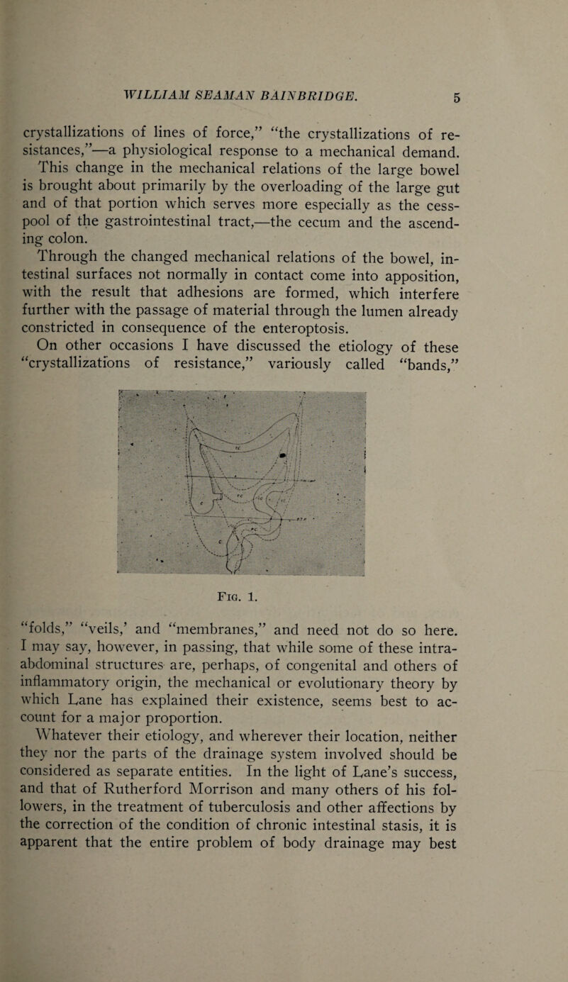 crystallizations of lines of force,” “the crystallizations of re¬ sistances,”—a physiological response to a mechanical demand. This change in the mechanical relations of the large bowel is brought about primarily by the overloading of the large gut and of that portion which serves more especially as the cess¬ pool of the gastrointestinal tract,—the cecum and the ascend¬ ing colon. Through the changed mechanical relations of the bowel, in¬ testinal surfaces not normally in contact come into apposition, with the result that adhesions are formed, which interfere further with the passage of material through the lumen already constricted in consequence of the enteroptosis. On other occasions I have discussed the etiology of these “crystallizations of resistance,” variously called “bands,” Fig. 1. “folds,” “veils/ and “membranes,” and need not do so here. I may say, however, in passing, that while some of these intra¬ abdominal structures are, perhaps, of congenital and others of inflammatory origin, the mechanical or evolutionary theory by which Lane has explained their existence, seems best to ac¬ count for a major proportion. Whatever their etiology, and wherever their location, neither they nor the parts of the drainage system involved should be considered as separate entities. In the light of Lane’s success, and that of Rutherford Morrison and many others of his fol¬ lowers, in the treatment of tuberculosis and other affections by the correction of the condition of chronic intestinal stasis, it is apparent that the entire problem of body drainage may best