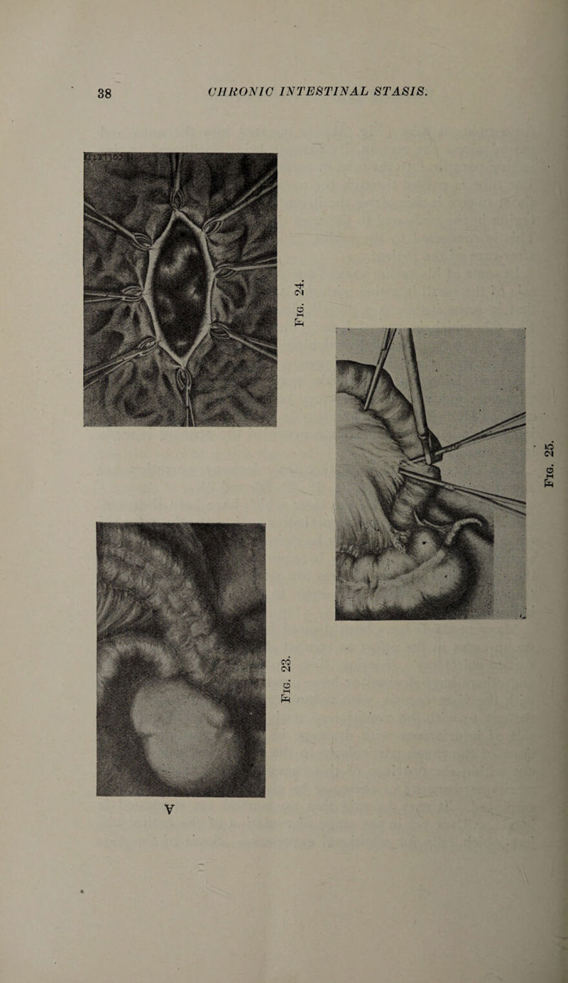 Fig. 25.