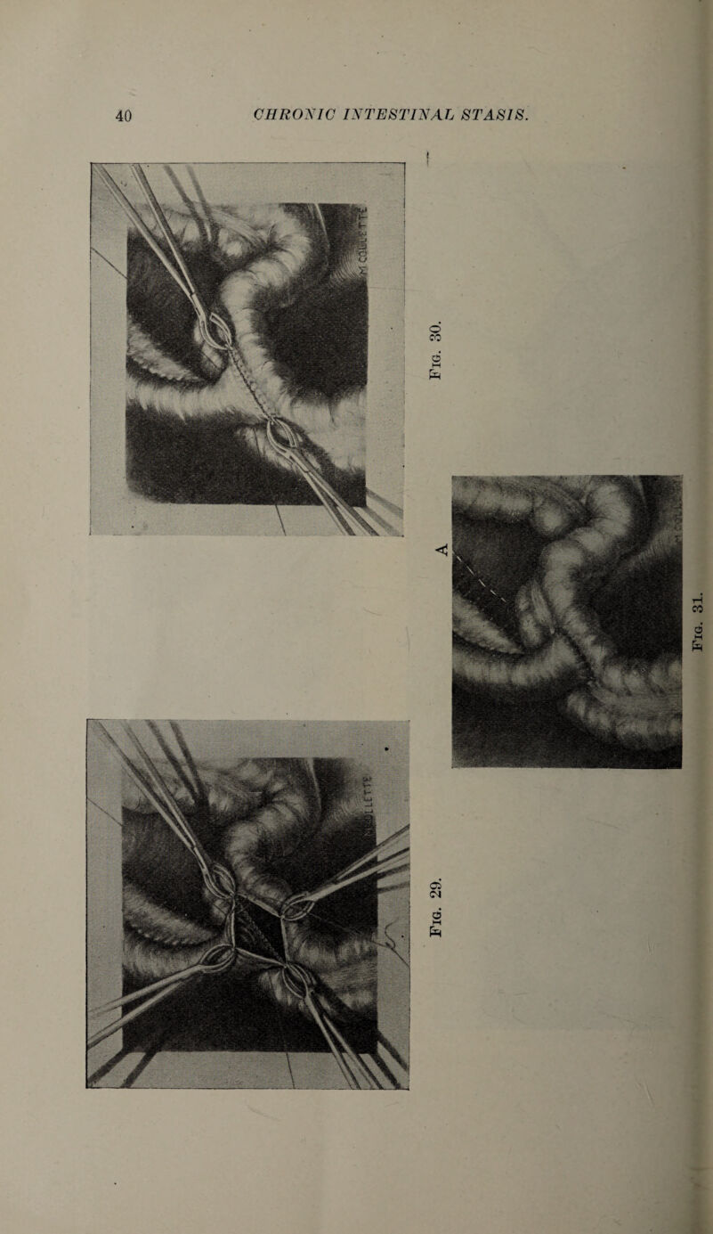 Fig. 31