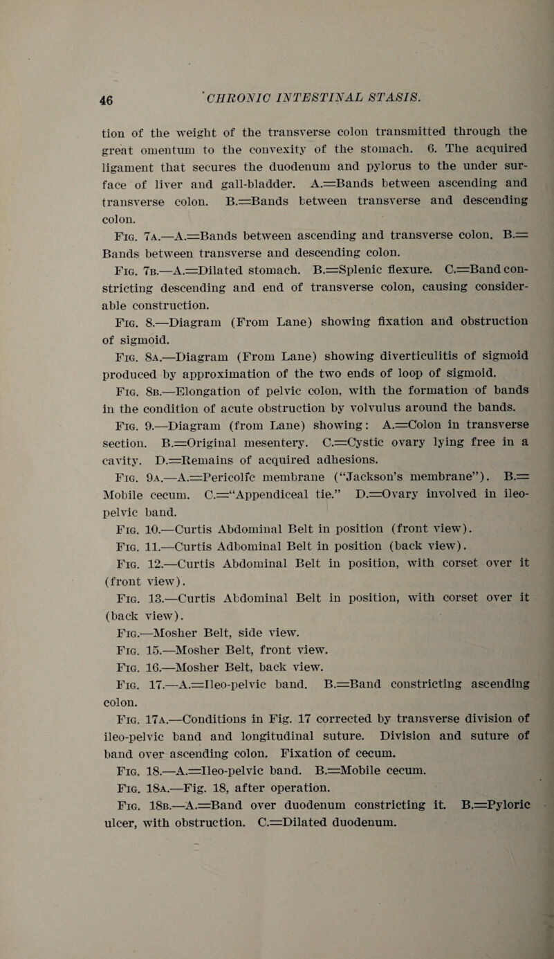 tion of tlie weight of the transverse colon transmitted through the great omentum to the convexity of the stomach. 6. The acquired ligament that secures the duodenum and pylorus to the under sur¬ face of liver and gall-bladder. A.=Bands between ascending and transverse colon. B.=Bands between transverse and descending colon. Fig. 7a.—A.=Bands between ascending and transverse colon. B.= Bands between transverse and descending colon. Fig. 7b.—A.=Dilated stomach. B.=Splenic flexure. C.=Band con¬ stricting descending and end of transverse colon, causing consider¬ able construction. Fig. 8.—Diagram (From Lane) showing fixation and obstruction of sigmoid. Fig. 8a.—Diagram (From Lane) showing diverticulitis of sigmoid produced by approximation of the two ends of loop of sigmoid. Fig. 8b.—Elongation of pelvic colon, with the formation of bands in the condition of acute obstruction by volvulus around the bands. Fig. 9.—Diagram (from Lane) showing: A.=Colon in transverse section. B.=Original mesentery. C.=Ctystic ovary lying free in a cavity. D.=Remains of acquired adhesions. Fig. 9a.—A.—Pericolic membrane (“Jackson’s membrane”). B.= Mobile cecum. C.—‘Appendiceal tie.” D.=Ovary involved in ileo- pelvic band. Fig. 10.—Curtis Abdominal Belt in position (front view). Fig. 11.—Curtis Adbominal Belt in position (back view). Fig. 12.—Curtis Abdominal Belt in position, with corset over it (front view). Fig. 13.—Curtis Abdominal Belt in position, with corset over it (back view). Fig.—Mosher Belt, side view. Fig. 15.—Mosher Belt, front view. Fig. 16.—Mosher Belt, back view. Fig. 17.—A.=Ileo-pelvic band. B.=Band constricting ascending colon. Fig. 17a.—Conditions in Fig. 17 corrected by transverse division of ileo-pelvic band and longitudinal suture. Division and suture of band over ascending colon. Fixation of cecum. Fig. 18.—A—Ileo-pelvic band. B —Mobile cecum. Fig. 18a.—Fig. 18, after operation. Fig. 18b.—A.=Band over duodenum constricting it. B.=Pyloric ulcer, with obstruction. C.=Dilated duodenum.