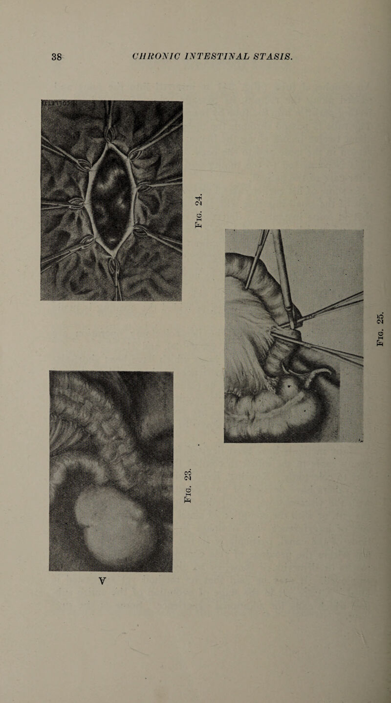 V Fig. 25