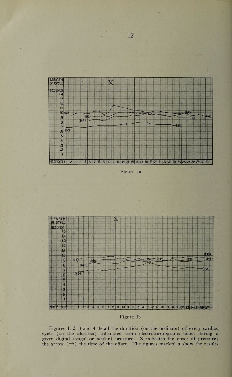 Figure lb Figures 1, 2, 3 and 4 detail the duration (on the ordinate) of every cardiac cycle (on the abscissa) calculated from electrocardiograms taken during a given digital (vagal or ocular) pressure. X indicates the onset of pressure; the arrow (—>) the time of the offset. The figures marked a show the results