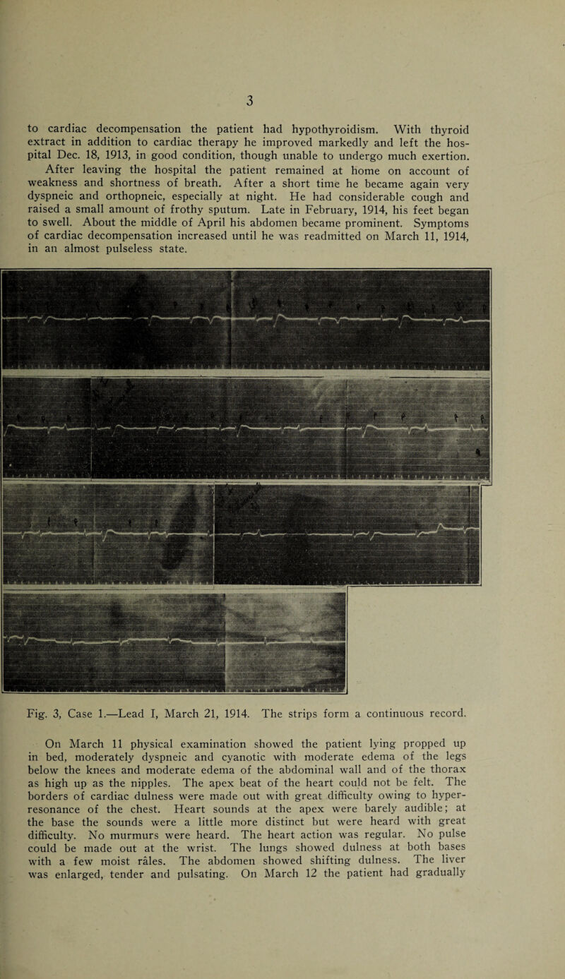 to cardiac decompensation the patient had hypothyroidism. With thyroid extract in addition to cardiac therapy he improved markedly and left the hos¬ pital Dec. 18, 1913, in good condition, though unable to undergo much exertion. After leaving the hospital the patient remained at home on account of weakness and shortness of breath. After a short time he became again very dyspneic and orthopneic, especially at night. He had considerable cough and raised a small amount of frothy sputum. Late in February, 1914, his feet began to swell. About the middle of April his abdomen became prominent. Symptoms of cardiac decompensation increased until he was readmitted on March 11, 1914, in an almost pulseless state. Fig. 3, Case 1.—Lead I, March 21, 1914. The strips form a continuous record. On March 11 physical examination showed the patient lying propped up in bed, moderately dyspneic and cyanotic with moderate edema of the legs below the knees and moderate edema of the abdominal wall and of the thorax as high up as the nipples. The apex beat of the heart could not be felt. The borders of cardiac dulness were made out with great difficulty owing to hyper¬ resonance of the chest. Heart sounds at the apex were barely audible; at the base the sounds were a little more distinct but were heard with great difficulty. No murmurs were heard. The heart action was regular. No pulse could be made out at the wrist. The lungs showed dulness at both bases with a few moist rales. The abdomen showed shifting dulness. The liver was enlarged, tender and pulsating. On March 12 the patient had gradually