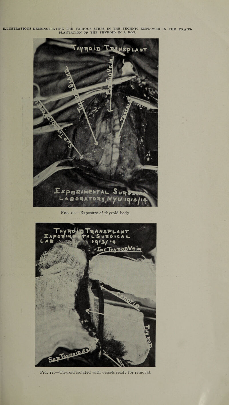 PLANTATION OF THE THYROID IN A DOG. Fig. io.—Exposure of thyroid body. Fig. ii.—Thyroid isolated with vessels ready for removal