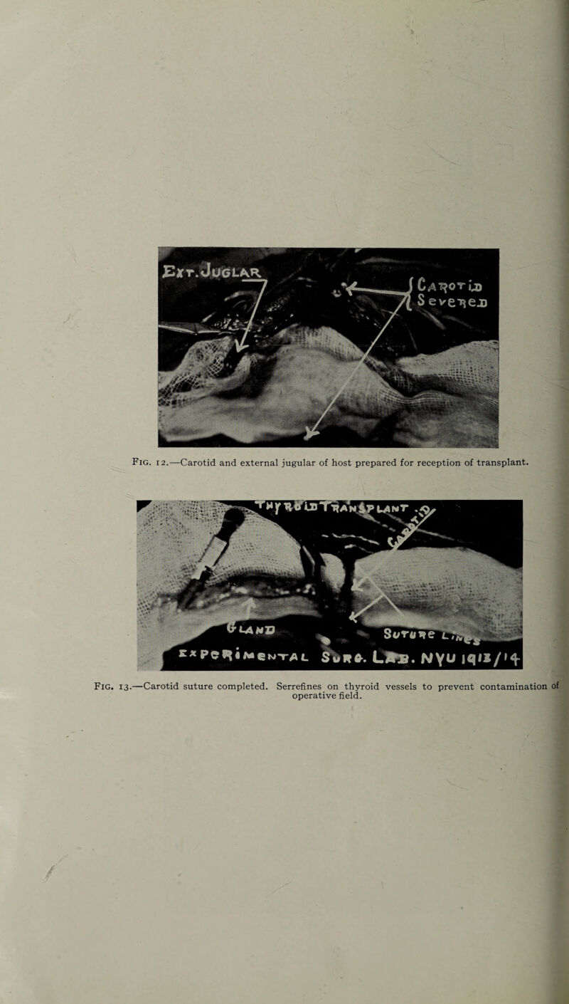 operative field.