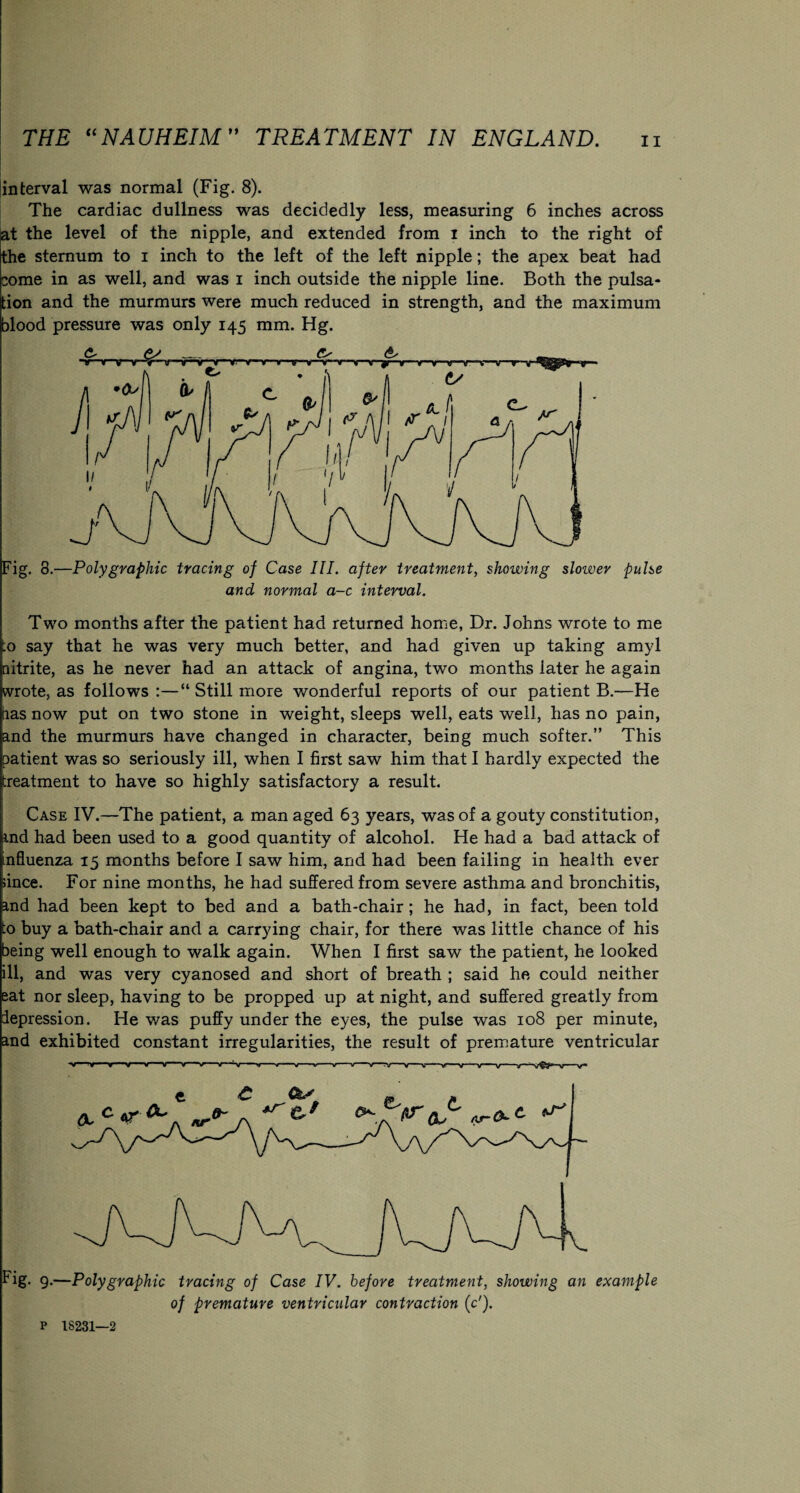 interval was normal (Fig. 8). The cardiac dullness was decidedly less, measuring 6 inches across at the level of the nipple, and extended from i inch to the right of the sternum to i inch to the left of the left nipple; the apex beat had come in as well, and was i inch outside the nipple line. Both the pulsa¬ tion and the murmurs were much reduced in strength, and the maximum blood pressure was only 145 mm. Hg. Fig. 8.—Poly graphic tracing of Case III. after treatment, showing sloiver pulse and normal a-c interval. Two months after the patient had returned home, Dr. Johns wrote to me to say that he was very much better, and had given up taking amyl nitrite, as he never had an attack of angina, two months later he again wrote, as follows :—“ Still more wonderful reports of our patient B.—He has now put on two stone in weight, sleeps well, eats well, has no pain, and the murmurs have changed in character, being much softer.” This patient was so seriously ill, when I first saw him that I hardly expected the treatment to have so highly satisfactory a result. Case IV.—The patient, a man aged 63 years, was of a gouty constitution, md had been used to a good quantity of alcohol. He had a bad attack of nfluenza 15 months before I saw him, and had been failing in health ever since. For nine months, he had suffered from severe asthma and bronchitis, and had been kept to bed and a bath-chair; he had, in fact, been told to buy a bath-chair and a carrying chair, for there was little chance of his being well enough to walk again. When I first saw the patient, he looked ill, and was very cyanosed and short of breath ; said he could neither eat nor sleep, having to be propped up at night, and suffered greatly from depression. He was puffy under the eyes, the pulse was 108 per minute, and exhibited constant irregularities, the result of premature ventricular -w— V—v X « x X S X X X- X X X—TV X X X—x—-V X X—V v- Fig. g.—Polygraphic tracing of Case IV. before treatment, showing an example of premature ventricular contraction (c'). p 1S231—2