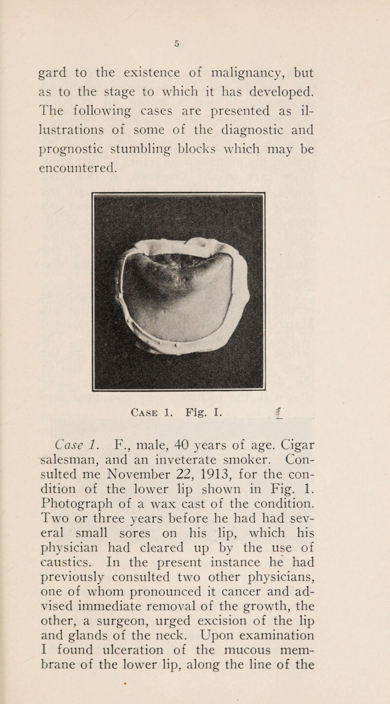 gard to the existence of malignancy, but as to the stage to which it has developed. The following cases are presented as il¬ lustrations of some of the diagnostic and prognostic stumbling blocks which may be encountered. Case 1. Fig. I. Case 1. F., male, 40 years of age. Cigar salesman, and an inveterate smoker. Con¬ sulted me November 22, 1913, for the con¬ dition of the lower lip shown in Fig. 1. Photograph of a wax cast of the condition. Two or three years before he had had sev¬ eral small sores on his lip, which his physician had cleared up by the use of caustics. In the present instance he had previously consulted two other physicians, one of whom pronounced it cancer and ad¬ vised immediate removal of the growth, the other, a surgeon, urged excision of the lip and glands of the neck. Upon examination I found ulceration of the mucous mem¬ brane of the lower lip, along the line of the