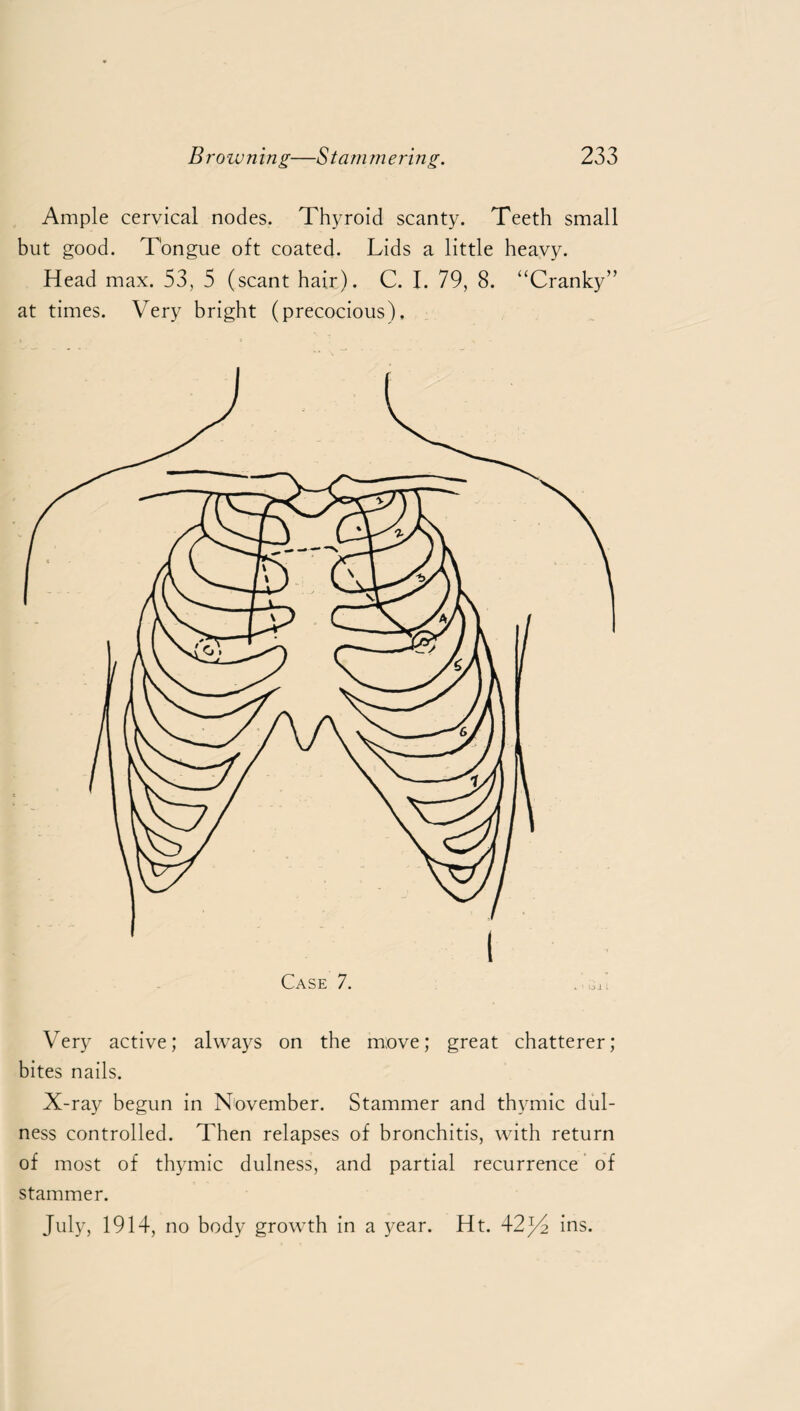 Ample cervical nodes. Thyroid scanty. Teeth small but good. Tongue oft coated. Lids a little heavy. Head max. 53, 5 (scant hair). C. I. 79, 8. “Cranky” at times. Very bright (precocious). Very active; always on the move; great chatterer; bites nails. X-ray begun in November. Stammer and thymic dul- ness controlled. Then relapses of bronchitis, with return of most of thymic dulness, and partial recurrence of stammer. July, 1914, no body growth in a year. Ht. 42ins.