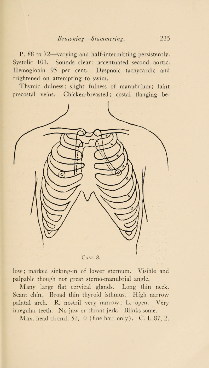 P. 88 to 72—varying and half-intermitting persistently. Systolic 101. Sounds clear; accentuated second aortic. Hemoglobin 95 per cent. Dyspnoic tachycardic and frightened on attempting to swim. Thymic dulness; slight fulness of manubrium:; faint precostal veins. Chicken-breasted; costal flanging be¬ low ; marked sinking-in of lower sternum. Visible and palpable though not great sterno-manubrial angle. Many large flat cervical glands. Long thin neck. Scant chin. Broad thin thyroid isthmus. High narrow palatal arch. R. nostril very narrow; L. open. Very irregular teeth. No jaw or throat jerk. Blinks some. Max. head circmf. 52, 0 (fine hair only). C. I. 87, 2.