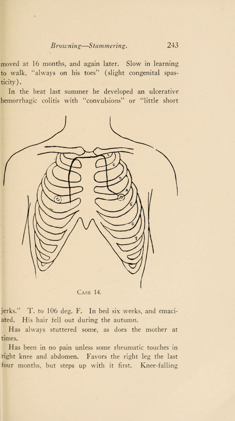 moved at 16 months, and again later. Slow in learning to walk, “always on his toes” (slight congenital spas¬ ticity). In the heat last summer he developed an ulcerative hemorrhagic colitis with “convulsions” or “little short jerks.” T. to 106 deg. F. In bed six weeks, and emaci¬ ated. His hair fell out during the autumn. Has always stuttered some, as does the mother at times. Has been in no pain unless some rheumatic touches in right knee and abdomen. Favors the right leg the last four months, but steps up with it first. Knee-falling
