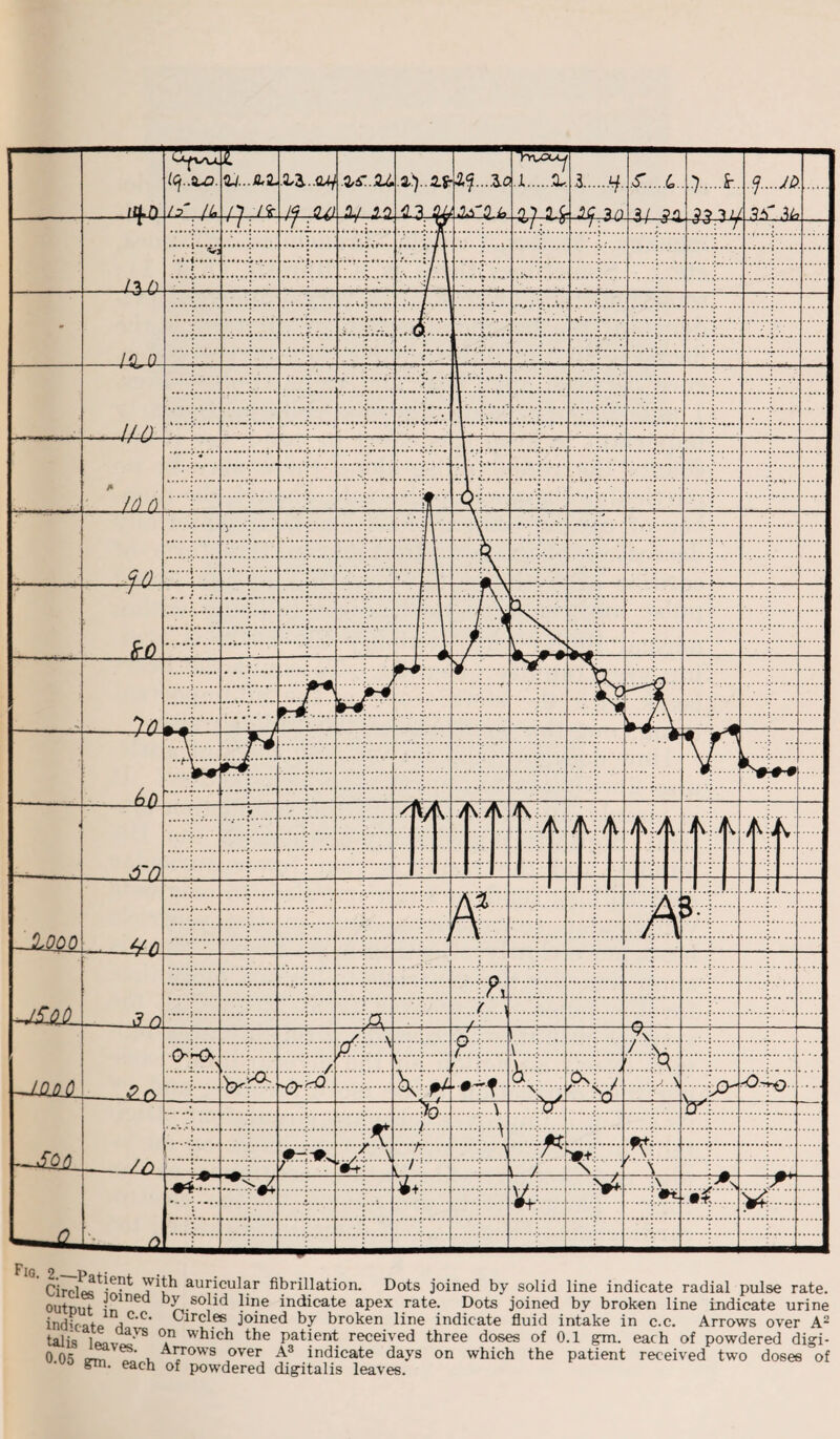 f'lG Circips^^ aur^cu^r fibrillation. Dots joined by solid line indicate radial pulse rate, output -^lned >,.sojid l*1?6 indicate apex rate. Dots joined by broken line indicate urine indkatP h'C’ (“arcles Joined by broken line indicate fluid intake in c.c. Arrows over A2 tabs liw* T Whlch the patient received three doses of 0.1 gm. each of powdered digi- 0 JvT , Arr°W8 over A3 indicate days on which the patient received two doses of