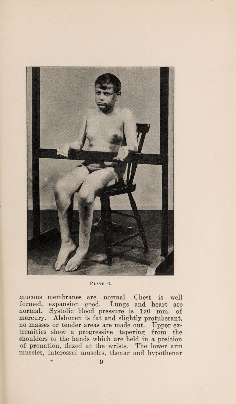 mucous membranes are normal. Chest is well formed, expansion good. Lungs and heart are normal. Systolic blood pressure is 120 mm. of mercury. Abdomen is fat and slightly protuberant, no masses or tender areas are made out. Upper ex¬ tremities show a progressive tapering from the shoulders to the hands which are held in a position of pronation, flexed at the wrists. The lower arm muscles, interossei muscles, thenar and hypothenar