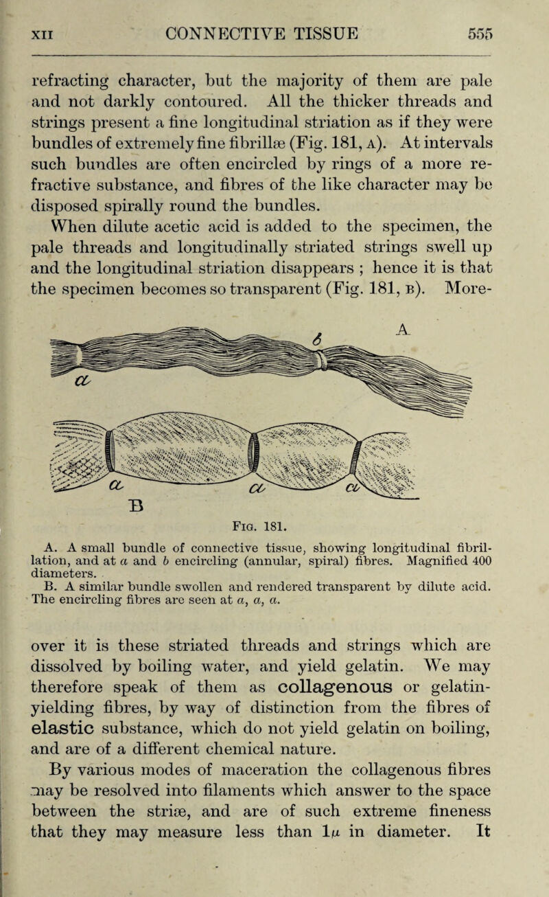 refracting character, but the majority of them are pale and not darkly contoured. All the thicker threads and strings present a fine longitudinal striation as if they were bundles of extremely fine fibrillse (Fig. 181, a). At intervals such bundles are often encircled by rings of a more re¬ fractive substance, and fibres of the like character may be disposed spirally round the bundles. When dilute acetic acid is added to the specimen, the pale threads and longitudinally striated strings swell up and the longitudinal striation disappears ; hence it is that the specimen becomes so transparent (Fig. 181, b). More- A. A small bundle of connective tissue, showing longitudinal fibril¬ lation, and at a and b encircling (annular, spiral) fibres. Magnified 400 diametei's. B. A similar bundle swollen and rendered transparent by dilute acid. The encircling fibres are seen at a, a, a. over it is these striated threads and strings which are dissolved by boiling water, and yield gelatin. We may therefore speak of them as collagenous or gelatin- yielding fibres, by way of distinction from the fibres of elastic substance, which do not yield gelatin on boiling, and are of a different chemical nature. By various modes of maceration the collagenous fibres may be resolved into filaments which answer to the space between the striee, and are of such extreme fineness that they may measure less than la in diameter. It