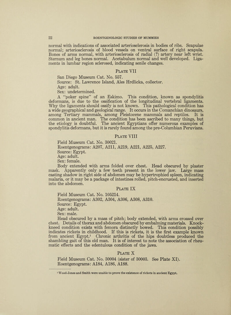 normal with indications of associated arteriosclerosis in bodies of ribs. Scapulae normal; arteriosclerosis of blood vessels on ventral surface of right scapula. Bones of arms normal, with arteriosclerosis of radial (?) artery near left wrist. Sternum and leg bones normal. Acetabulum normal and well developed. Liga¬ ments in lumbar region sclerosed, indicating senile changes. Plate VII San Diego Museum Cat. No. 557. Source: St. Lawrence Island, Ales Hrdlicka, collector. Age: adult. Sex: undetermined. A “poker spine” of an Eskimo. This condition, known as spondylitis deformans, is due to the ossification of the longitudinal vertebral ligaments. Why the ligaments should ossify is not known. This pathological condition has a wide geographical and geological range. It occurs in the Comanchian dinosaurs, among Tertiary mammals, among Pleistocene mammals and reptiles. It is common in ancient man. The condition has been ascribed to many things, but the etiology is doubtful. The ancient Egyptians offer numerous examples of spondylitis deformans, but it is rarely found among the pre-Columbian Peruvians. Plate VIII Field Museum Cat. No. 30021. Roentgenograms: A207, A211, A219, A221, A225, A227. Source: Egypt. Age: adult. Sex: female. Body extended with arms folded over chest. Head obscured by plaster mask. Apparently only a few teeth present in the lower jaw. Large mass casting shadow in right side of abdomen may be hypertrophied spleen, indicating malaria, or it may be a package of intestines rolled, pitch-encrusted, and inserted into the abdomen. Plate IX Field Museum Cat. No. 105214. Roentgenograms: A302, A304, A306, A308, A310. Source: Egypt. Age: adult. Sex: male. Head obscured by a mass of pitch; body extended, with arms crossed over chest. Details of thorax and abdomen obscured by embalming materials. Knock- kneed condition exists with femora distinctly bowed. This condition possibly indicates rickets in childhood. If this is rickets, it is the first example known from ancient Egypt.1 Chronic arthritis of the hips doubtless produced the shambling gait of this old man. It is of interest to note the association of rheu¬ matic effects and the edentulous condition of the jaws. Plate X Field Museum Cat. No. 30004 (sister of 30003. See Plate XI). Roentgenograms: A184, A186, A188. 1 Wood-Jones and Smith were unable to prove the existence of rickets in ancient Egypt.