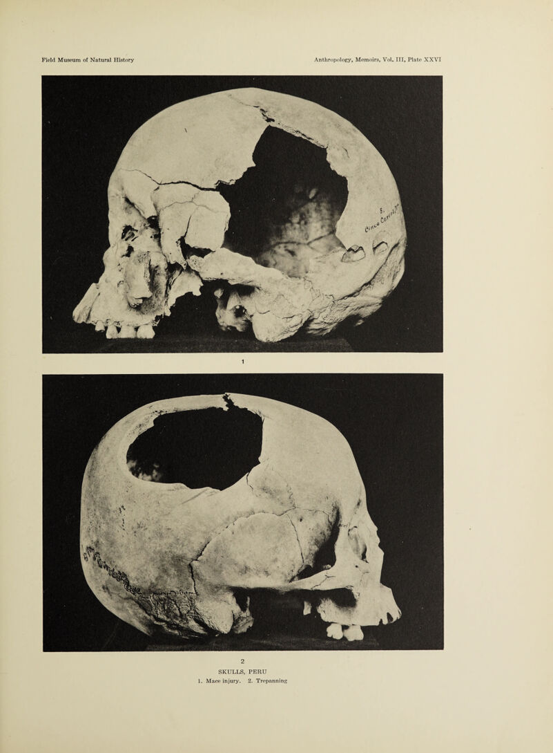 2 SKULLS, PERU