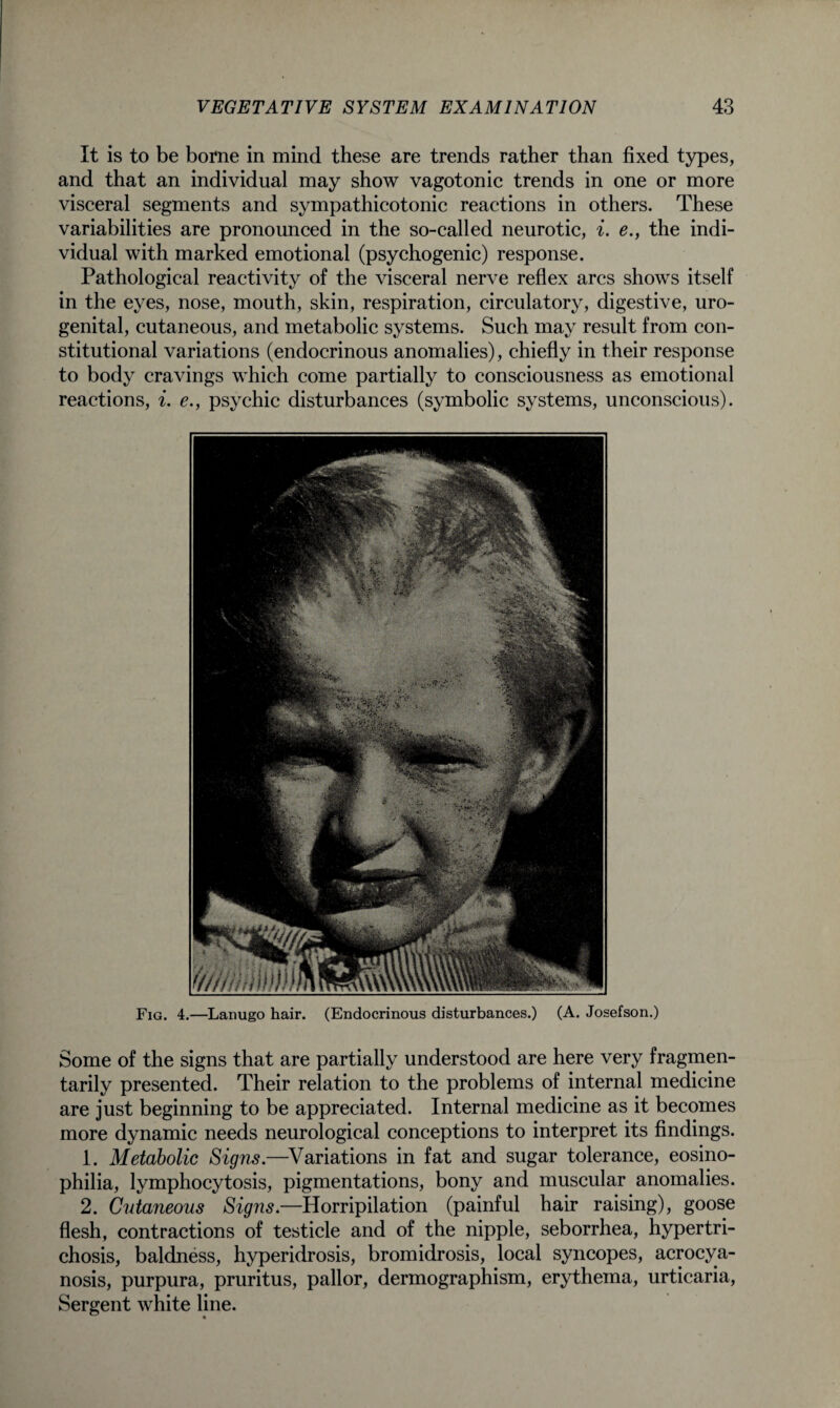 It is to be borne in mind these are trends rather than fixed types, and that an individual may show vagotonic trends in one or more visceral segments and sympathicotonic reactions in others. These variabilities are pronounced in the so-called neurotic, i. e., the indi¬ vidual with marked emotional (psychogenic) response. Pathological reactivity of the visceral nerve reflex arcs shows itself in the eyes, nose, mouth, skin, respiration, circulatory, digestive, uro¬ genital, cutaneous, and metabolic systems. Such may result from con¬ stitutional variations (endocrinous anomalies), chiefly in their response to body cravings which come partially to consciousness as emotional reactions, i. e., psychic disturbances (symbolic systems, unconscious). Fig. 4.—Lanugo hair. (Endocrinous disturbances.) (A. Josefson.) Some of the signs that are partially understood are here very fragmen- tarily presented. Their relation to the problems of internal medicine are just beginning to be appreciated. Internal medicine as it becomes more dynamic needs neurological conceptions to interpret its findings. 1. Metabolic Signs.—Variations in fat and sugar tolerance, eosino- philia, lymphocytosis, pigmentations, bony and muscular anomalies. 2. Cutaneous Signs.—Horripilation (painful hair raising), goose flesh, contractions of testicle and of the nipple, seborrhea, hypertri¬ chosis, baldness, hyperidrosis, bromidrosis, local syncopes, acrocya¬ nosis, purpura, pruritus, pallor, dermographism, erythema, urticaria, Sergent white line.