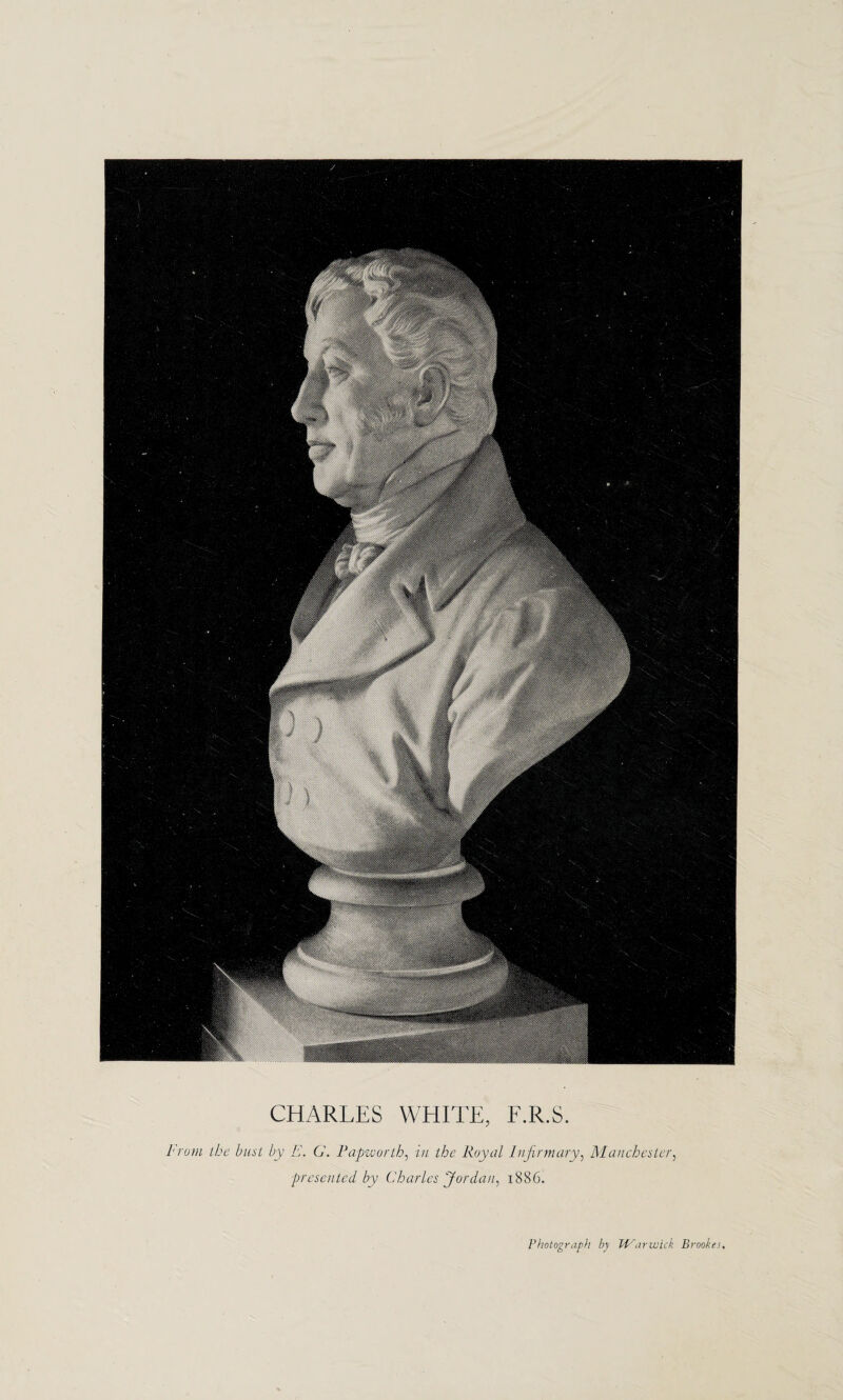 CHARLES WHITE, F.R.S. From the bust by E. C. Papworth, in the Royal Infirmary, Manchester, presented by Charles Jordan, 1886. Photograph by Warwick Brookes,