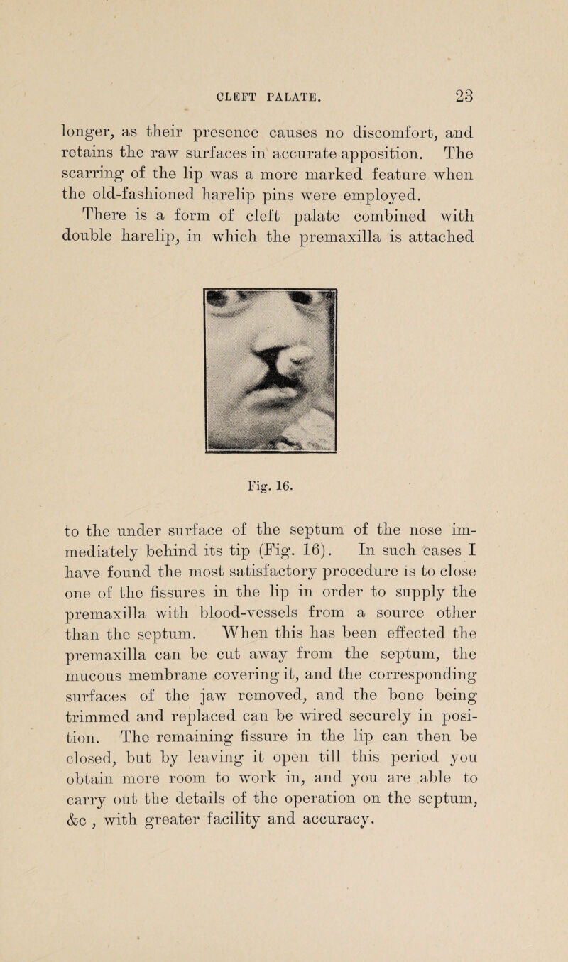 longer, as their presence causes no discomfort, and retains the raw surfaces in accurate apposition. The scarring of the lip was a more marked feature when the old-fashioned harelip pins were employed. There is a form of cleft palate combined with double harelip, in which the premaxilla is attached h 1 o* 16. to the under surface of the septum of the nose im¬ mediately behind its tip (Pig. 16). In such cases I have found the most satisfactory procedure is to close one of the fissures in the lip in order to supply the premaxilla with blood-vessels from a source other than the septum. When this has been effected the premaxilla can be cut away from the septum, the mucous membrane covering it, and the corresponding surfaces of the jaw removed, and the bone being trimmed and replaced can be wired securely in posi¬ tion. The remaining fissure in the lip can then be closed, but by leaving it open till this period you obtain more room to work in, and you are able to carry out the details of the operation on the septum, &c , with greater facility and accuracy.