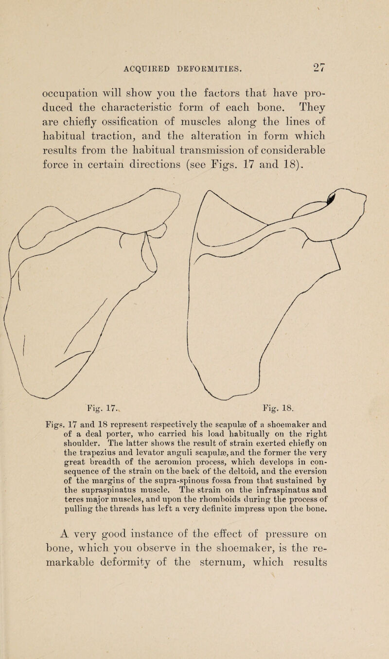 occupation will show you the factors that have pro¬ duced the characteristic form of each bone. They are chiefly ossification of muscles along the lines of habitual traction, and the alteration in form which results from the habitual transmission of considerable force in certain directions (see Figs. 17 and 18). Fig. 17. Fig. 18. Figs. 17 and 18 represent respectively the scapnlse of a shoemaker and of a deal porter, who carried his load habitually on the right shoulder. The latter shows the result of strain exerted chiefly on the trapezius and levator anguli scapulae, and the former the very great breadth of the acromion process, which develops in con¬ sequence of the strain on the back of the deltoid, and the eversion of the margins of the supra-spinous fossa from that sustained by the supraspinatus muscle. The strain on the infraspinatus and teres major muscles, and upon the rhomboids during the process of pulling the threads has left a very definite impress upon the bone. A very good instance of the effect of pressure on bone, which you observe in the shoemaker, is the re- y «y y markable deformity of the sternum, which results