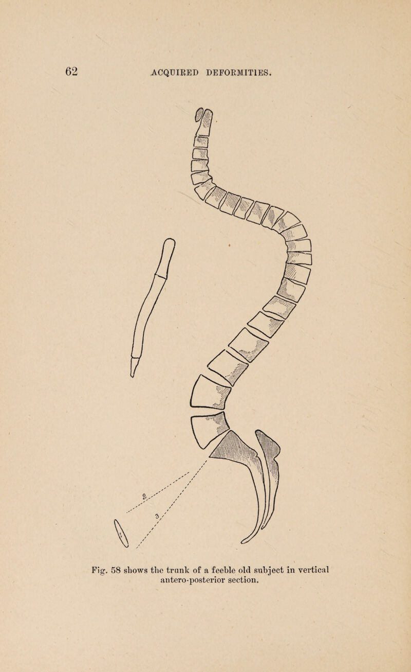 Fig. 58 shows the trunk of a feeble old subject in vertical antero-posterior section.