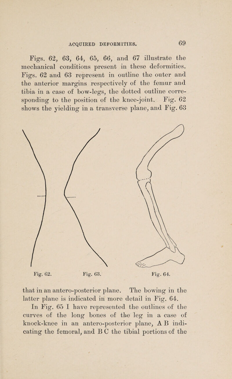Figs. 62, 63, 64, 65, 66, and 67 illustrate the mechanical conditions present in these deformities. Figs. 62 and 63 represent in outline the outer and the anterior margins respectively of the femur and tibia in a case of bow-legs, the dotted outline corre¬ sponding to the position of the knee-joint. Fig. 62 shows the yielding in a transverse plane, and Fig. 63 that in an antero-posterior plane. The bowing in the latter plane is indicated in more detail in Fig. 64. In Fig. 65 I have represented the outlines of the curves of the long bones of the leg in a case of knock-knee in an antero-posterior plane, A B indi¬ cating the femoral, and B C the tibial portions of the