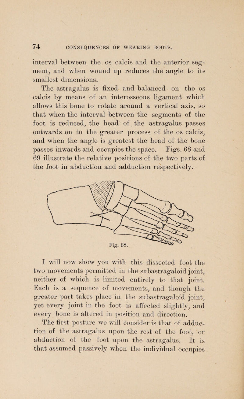interval between the os calcis and the anterior seg¬ ment,, and when wound up reduces the angle to its smallest dimensions. The astragalus is fixed and balanced on the os calcis by means of an interosseous ligament which allows this boue to rotate around a vertical axis, so that when the interval between the segments of the foot is reduced, the head of the astragalus passes outwards on to the greater process of the os calcis, and when the angle is greatest the head of the bone passes inwards and occupies the space. Figs. 68 and 69 illustrate the relative positions of the two parts of the foot in abduction and adduction respectively. I will now show you with this dissected foot the two movements permitted in the subastragaloid joint, neither of which is limited entirely to that joint. Each is a sequence of movements, and though the greater part takes place in the subastragaloid joint, yet every joint in the foot is affected slightly, and every bone is altered in position and direction. The first posture we will consider is that of adduc¬ tion of the astragalus upon the rest of the foot, or abduction of the foot upon the astragalus. It is that assumed passively when the individual occupies