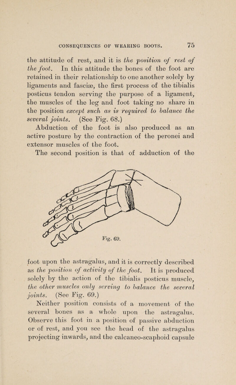 the attitude of rest, and it is the position of rest of the foot. In this attitude the bones of the foot are retained in their relationship to one another solely by ligaments and fascise, the first process of the tibialis posticus tendon serving the purpose of a ligament, the muscles of the leg and foot taking no share in the position except such as is required to balance the several joints. (See Fig. 68.) Abduction of the foot is also produced as an active posture by the contraction of the peronei and extensor muscles of the foot. The second position is that of adduction of the foot upon the astragalus, and it is correctly described as the position of activity of the foot. It is produced solely by the action of the tibialis posticus muscle, the other muscles only serving to balance the several joints. (See Fig. 69.) Neither position consists of a movement of the several bones as a whole upon the astragalus. Observe this foot in a position of passive abduction or of rest, and you see the bead of the astragalus projecting inwards, and the calcaneo-scaphoid capsule