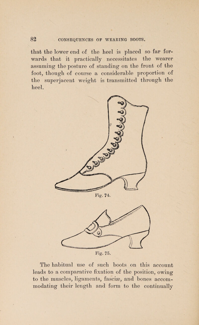 that the lower end of the heel is placed so far for¬ wards that it practically necessitates the wearer assuming the posture of standing on the front of the foot, though of course a considerable proportion of the superjacent weight is transmitted through the heel. Fig1. 74. The habitual use of such boots on this account leads to a comparative fixation of the position, owing to the muscles, ligaments, fasciae, and bones accom¬ modating their length and form to the continually