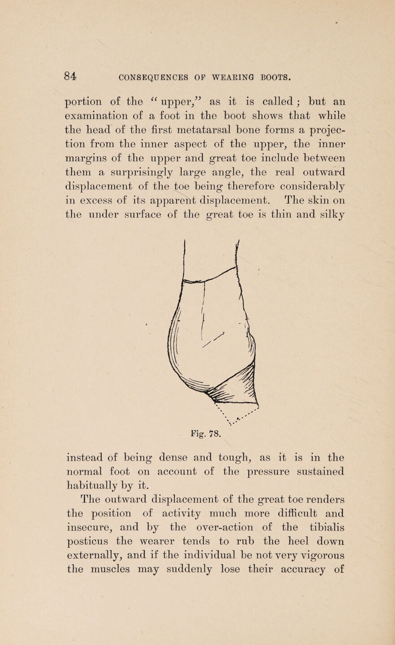 portion of the “ upper/’ as it is called; but an examination of a foot in the boot shows that while the head of the first metatarsal bone forms a projec¬ tion from the inner aspect of the upper, the inner margins of the upper and great toe include between them a surprisingly large angle, the real outward displacement of the toe being therefore considerably in excess of its apparent displacement. The skin on the under surface of the great toe is thin and silky instead of being dense and tough, as it is in the normal foot on account of the pressure sustained habitually by it. The outward displacement of the great toe renders the position of activity much more difficult and insecure, and by the over-action of the tibialis posticus the wearer tends to rub the heel down externally, and if the individual be not very vigorous the muscles may suddenly lose their accuracy of