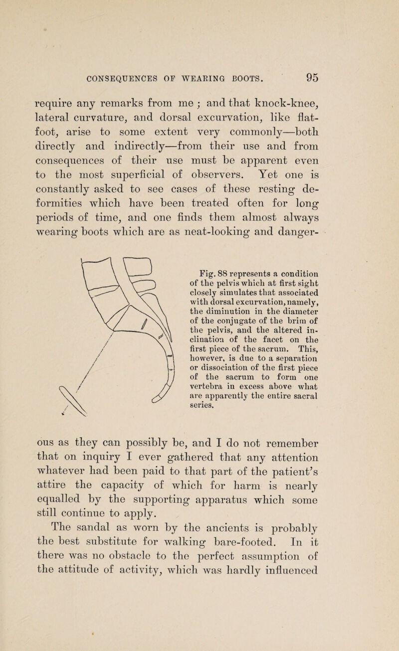 require any remarks from me ; and that knock-knee, lateral curvature, and dorsal excurvation, like flat- foot, arise to some extent very commonly—both directly and indirectly—from their use and from consequences of their use must be apparent even to the most superficial of observers. Yet one is constantly asked to see cases of these resting de¬ formities which have been treated often for long periods of time, and one finds them almost always wearing boots which are as neat-looking and danger- Fig. 88 represents a condition of the pelvis which at first sight closely simulates that associated with dorsal excurvation, namely, the diminution in the diameter of the conjugate of the brim of the pelvis, and the altered in¬ clination of the facet on the first piece of the sacrum. This, however, is due to a separation or dissociation of the first piece of the sacrum to form one vertebra in excess above what are apparently the entire sacral series. ous as they can possibly be, and I do not remember that on inquiry I ever gathered that any attention whatever had been paid to that part of the patienks attire the capacity of which for harm is nearly equalled by the supporting apparatus which some still continue to apply. The sandal as worn by the ancients is probably the best substitute for walking bare-footed. In it there was no obstacle to the perfect assumption of the attitude of activity, which was hardly influenced